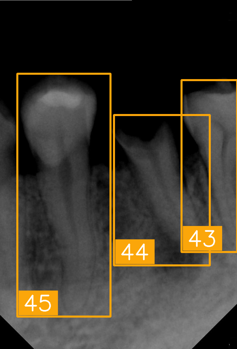 Diagnostics 15 02900 i005 Diagnostics 15 02900 i005