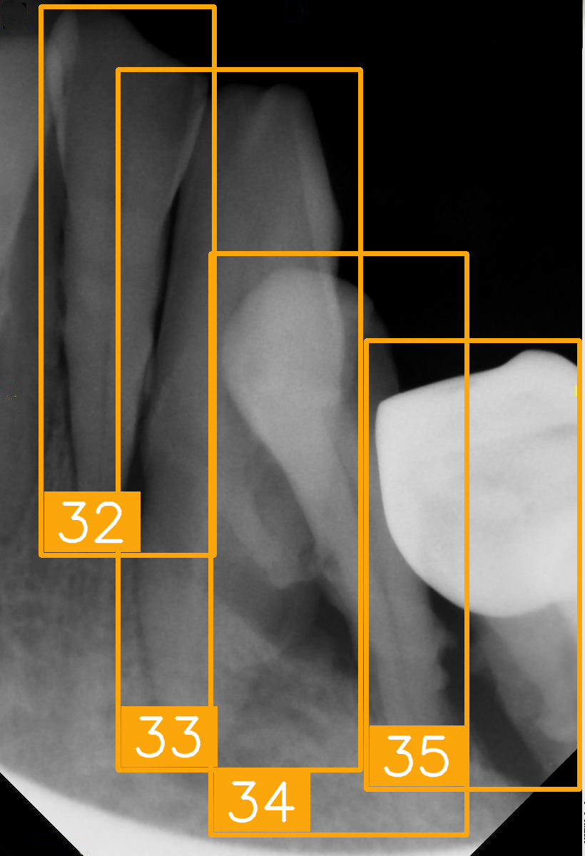 Diagnostics 15 02900 i006 Diagnostics 15 02900 i006