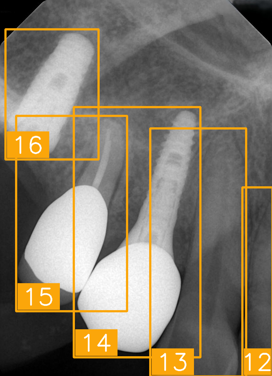 Diagnostics 15 02900 i007 Diagnostics 15 02900 i007
