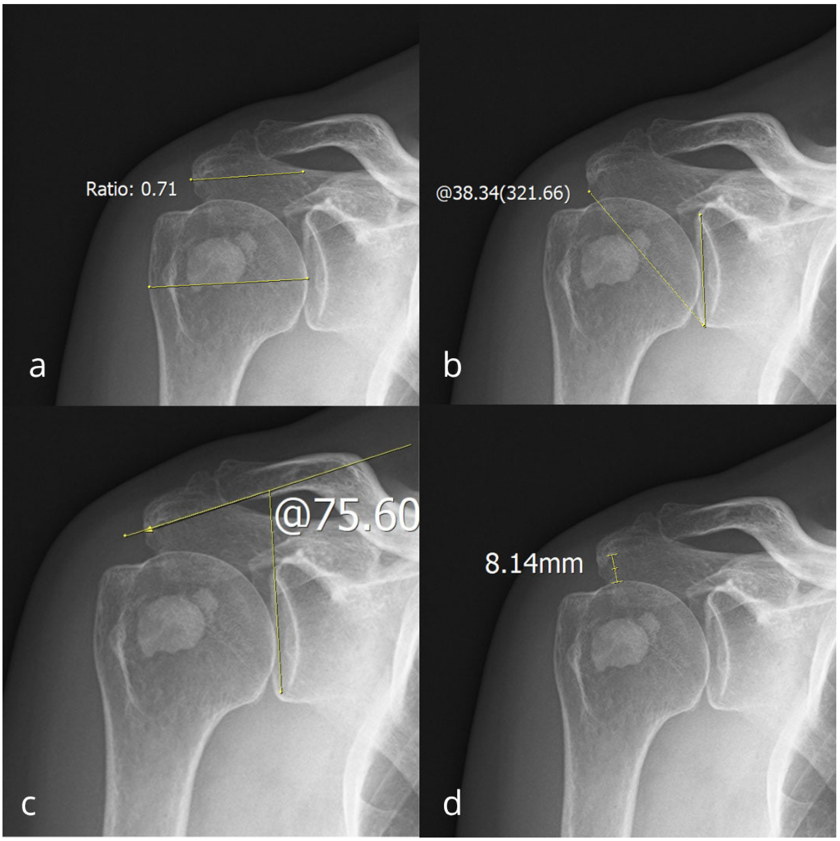 Diagnostics 15 02908 g003 Diagnostics 15 02908 g003