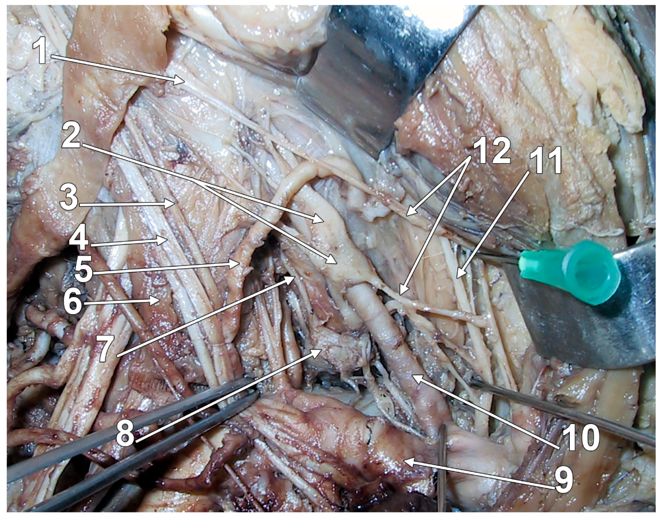 Diagnostics 15 02911 g004