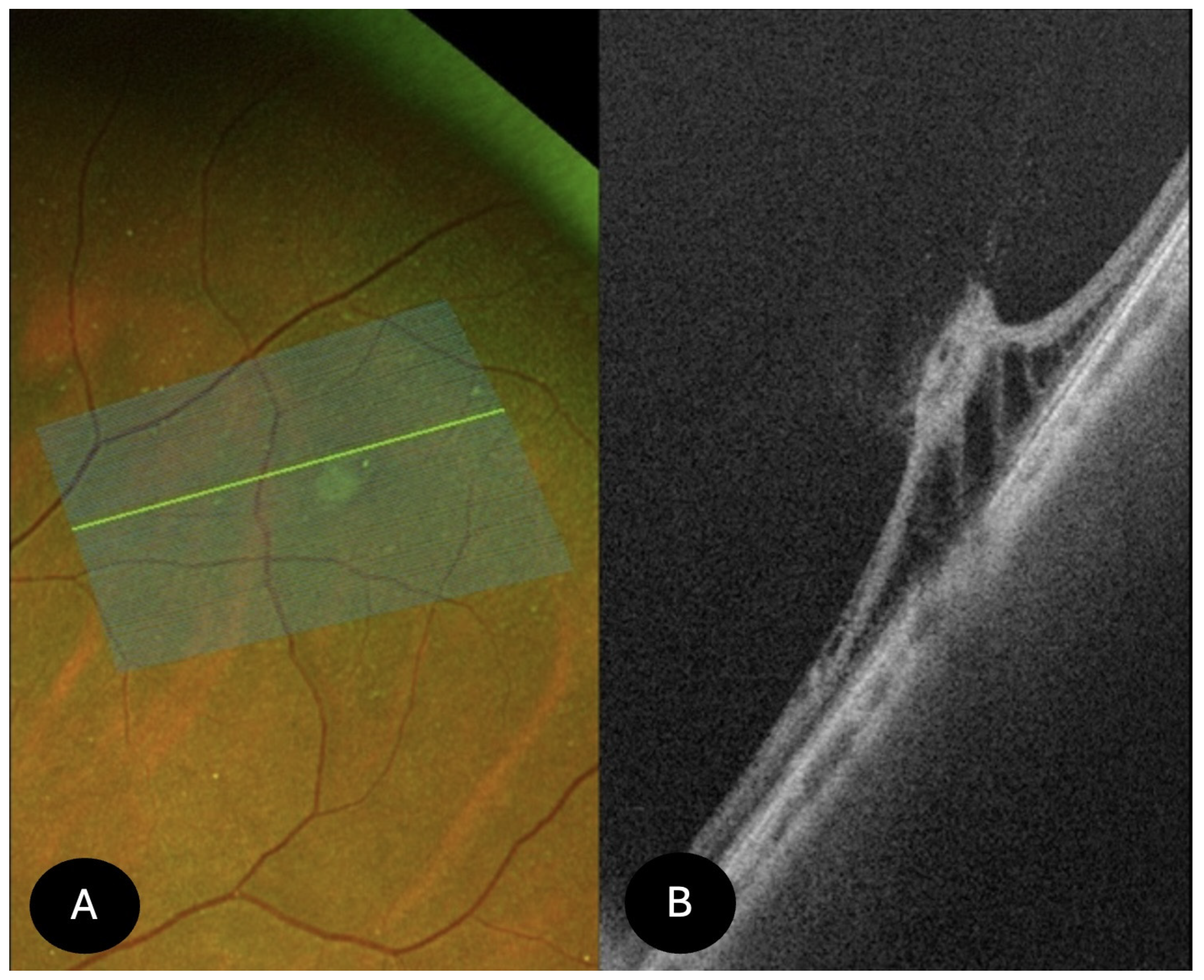 Diagnostics 15 02930 g002