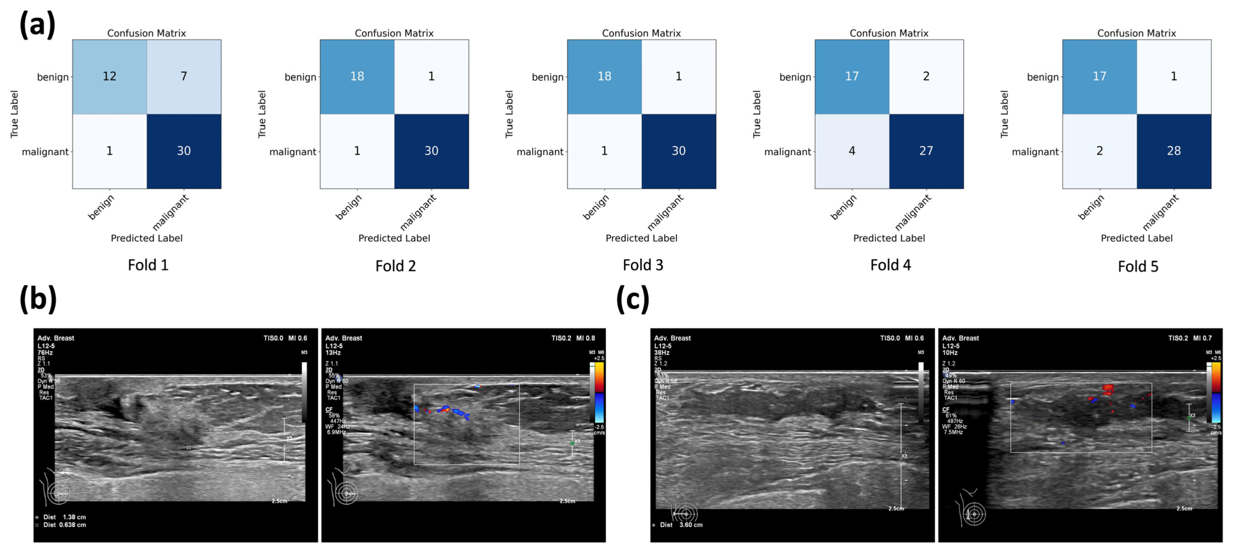 Diagnostics 15 02967 g005