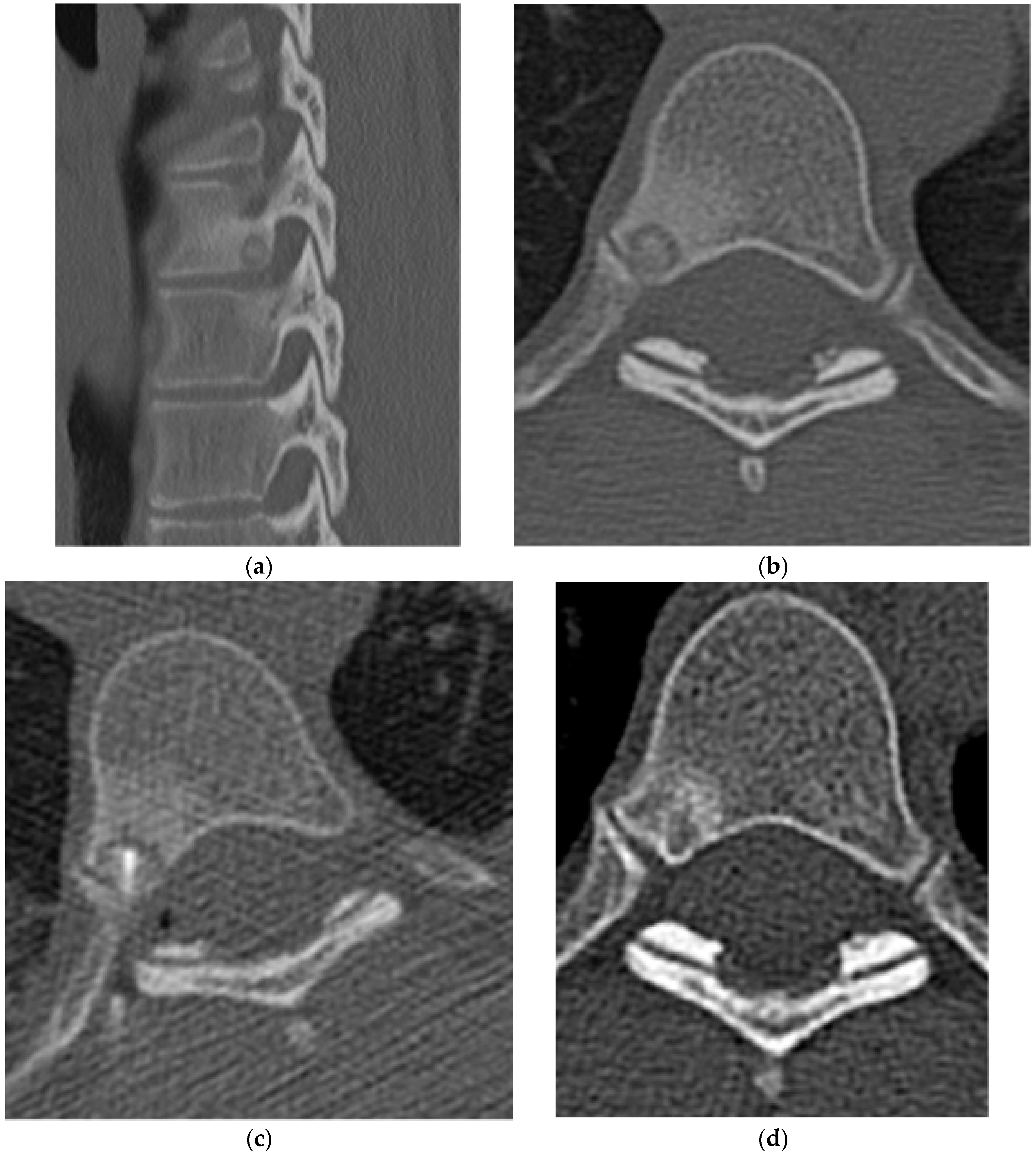 Diagnostics 15 02970 g002 Diagnostics 15 02970 g002