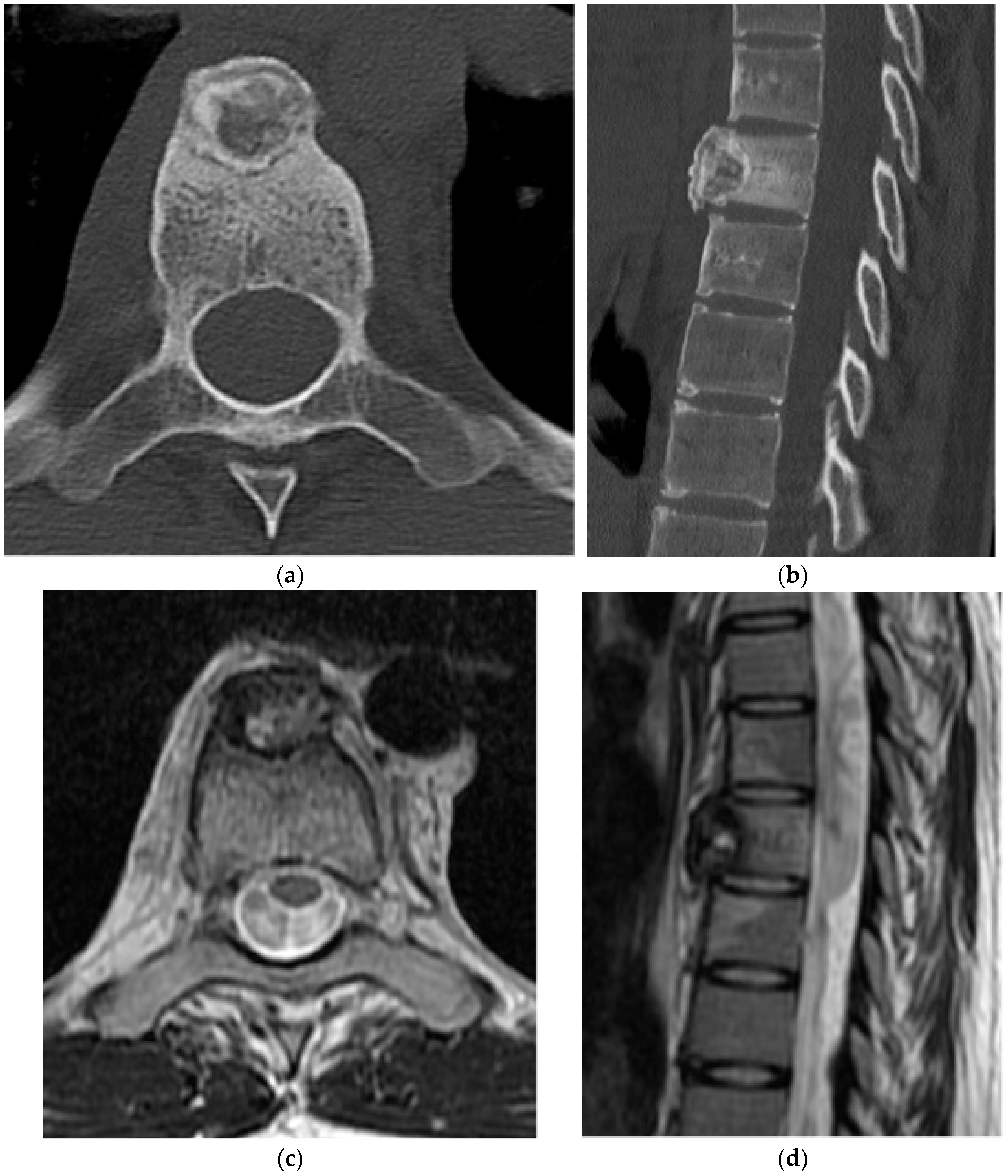 Diagnostics 15 02970 g003 Diagnostics 15 02970 g003