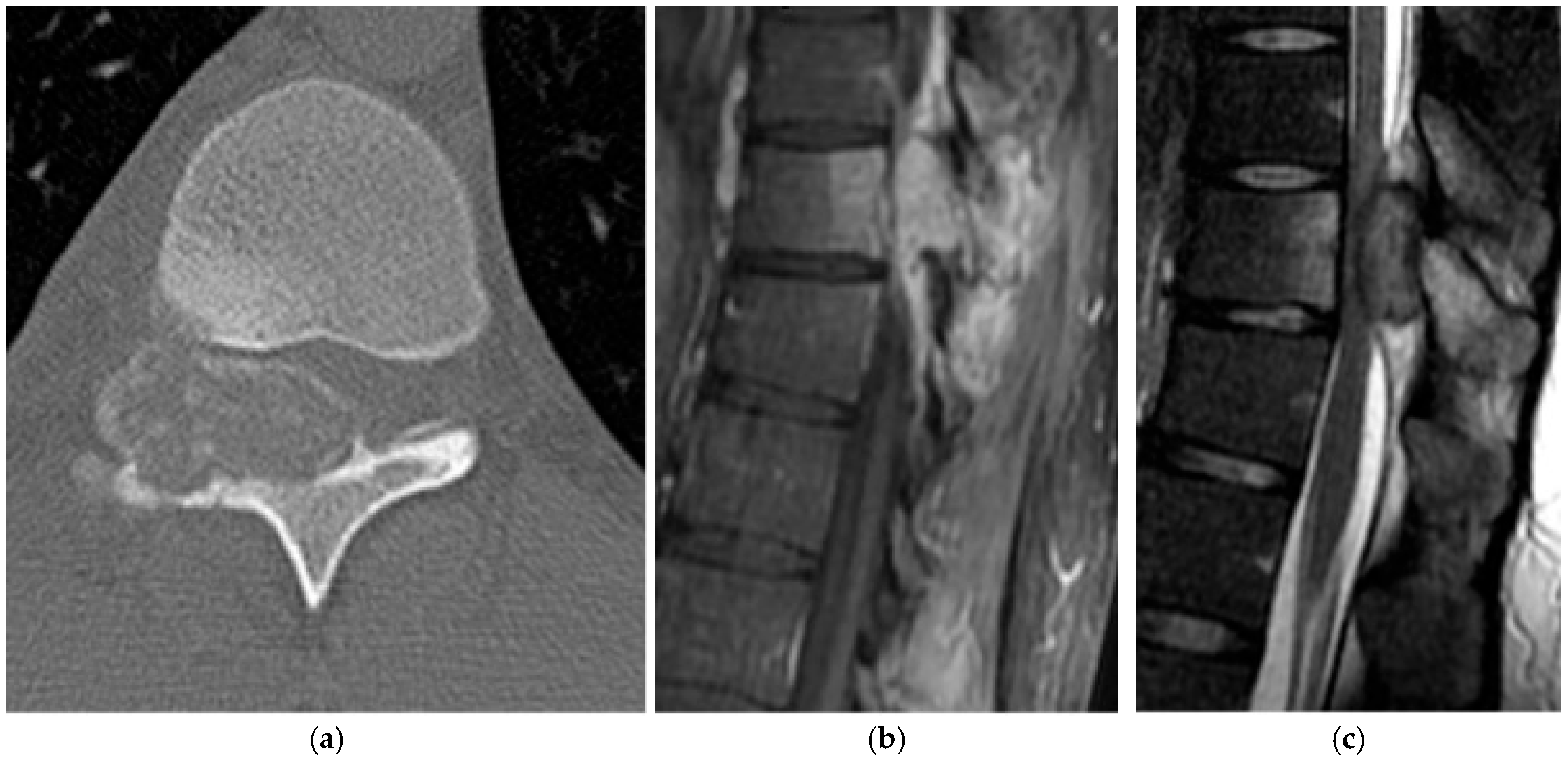 Diagnostics 15 02970 g004 Diagnostics 15 02970 g004