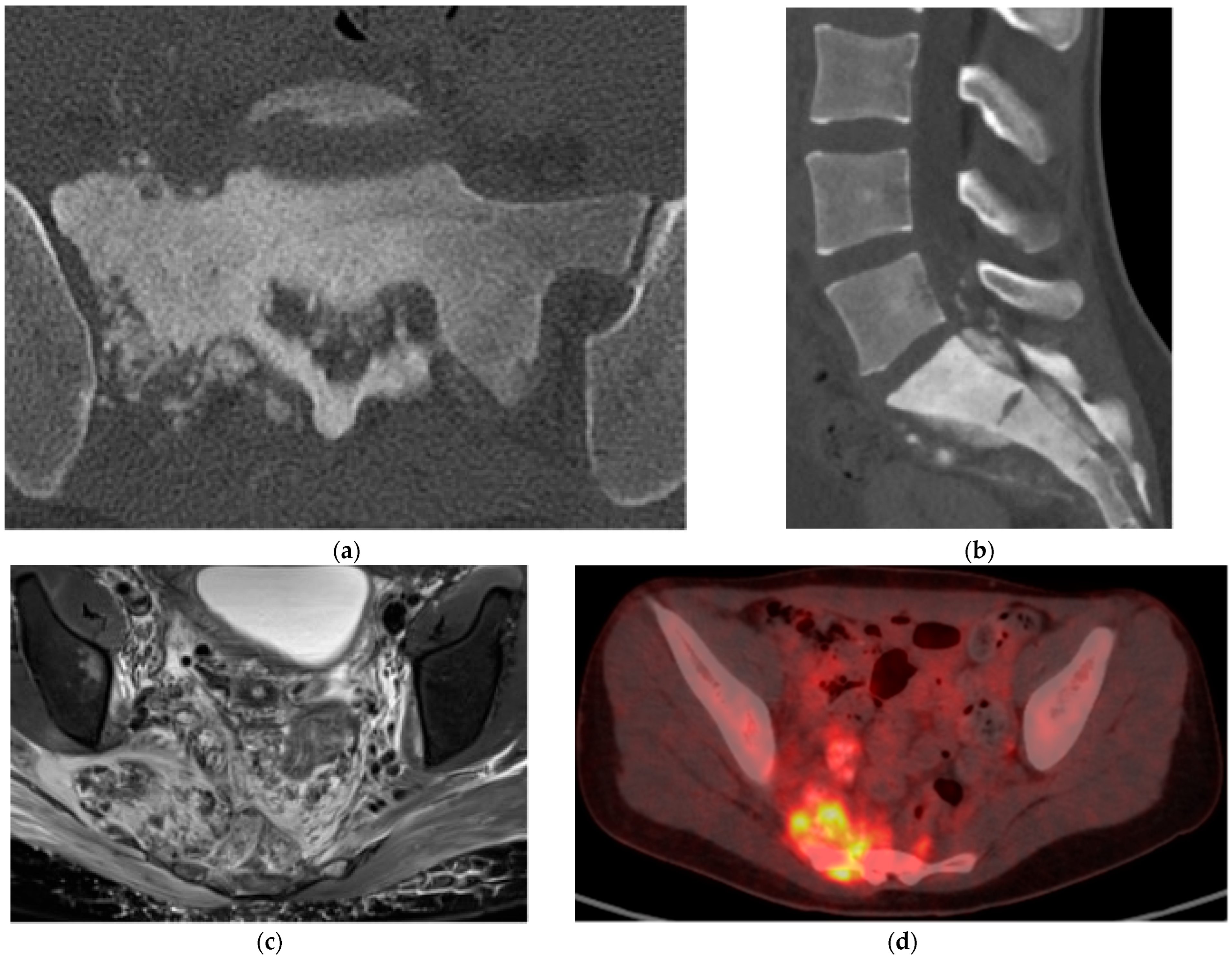 Diagnostics 15 02970 g005 Diagnostics 15 02970 g005