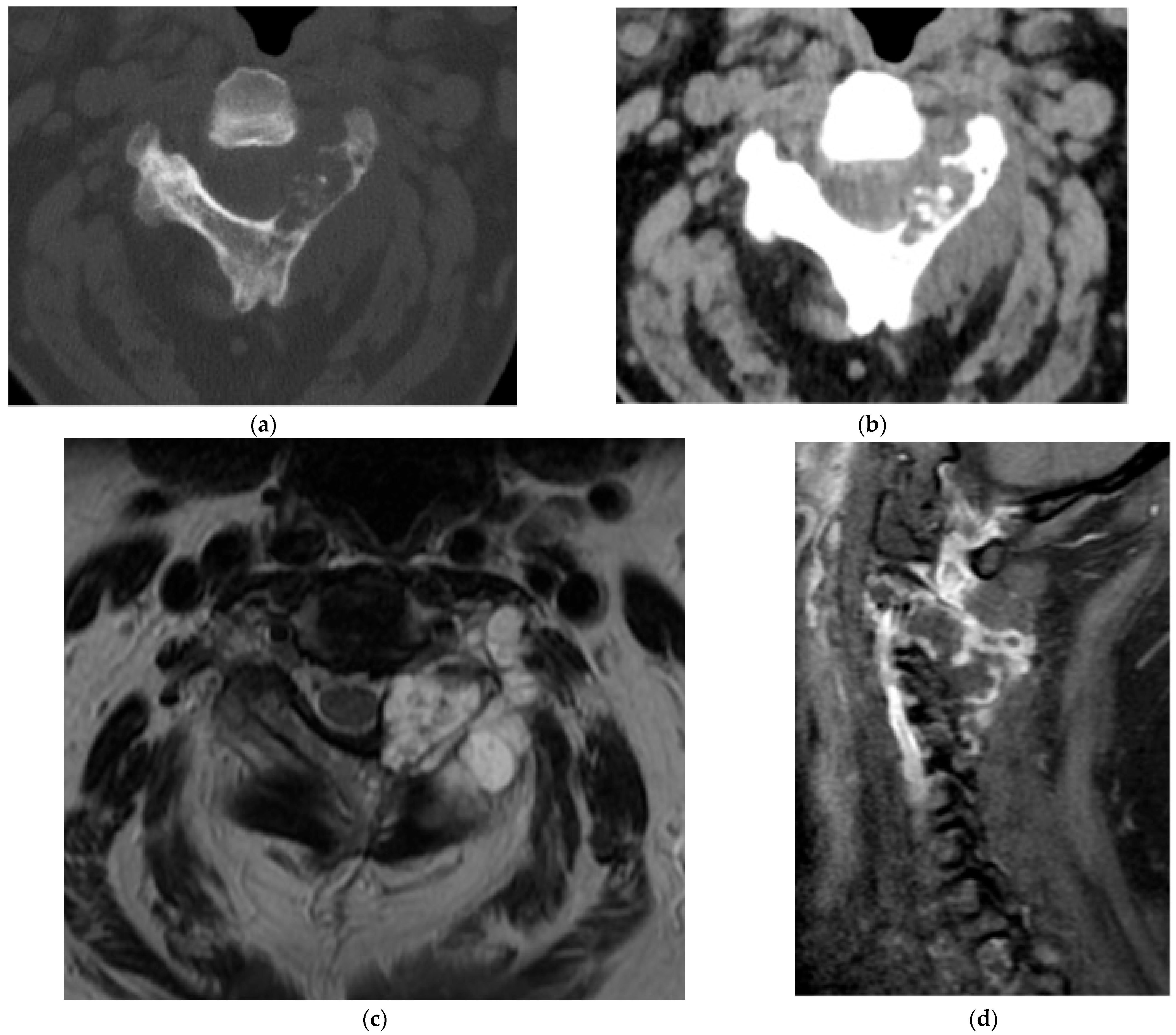 Diagnostics 15 02970 g009 Diagnostics 15 02970 g009