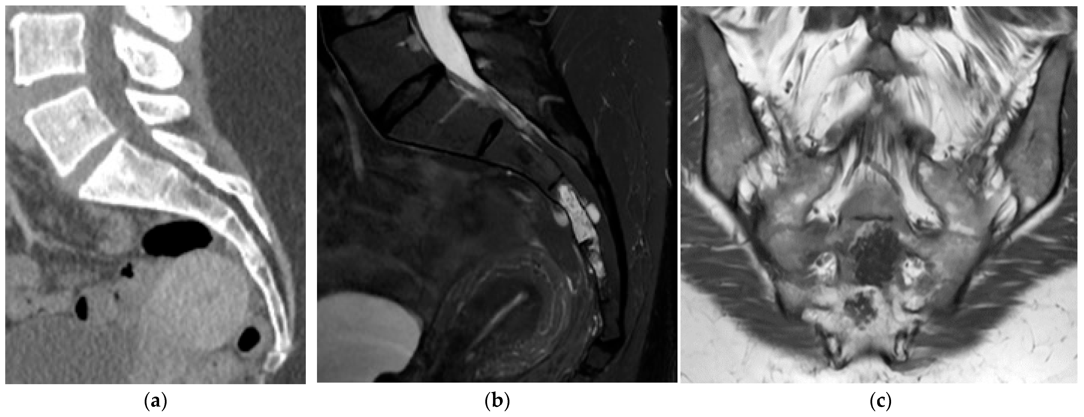 Diagnostics 15 02970 g010 Diagnostics 15 02970 g010