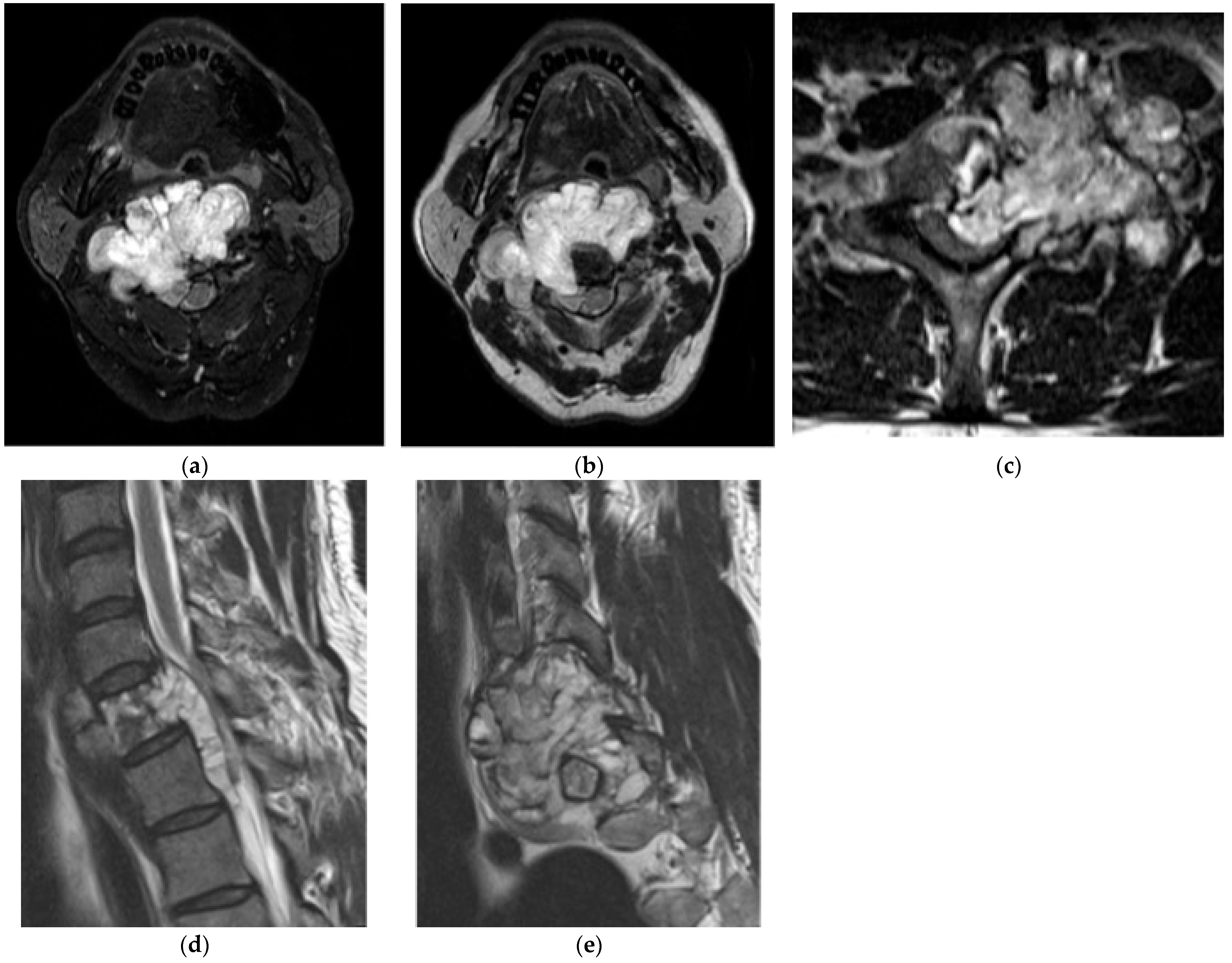 Diagnostics 15 02970 g011 Diagnostics 15 02970 g011