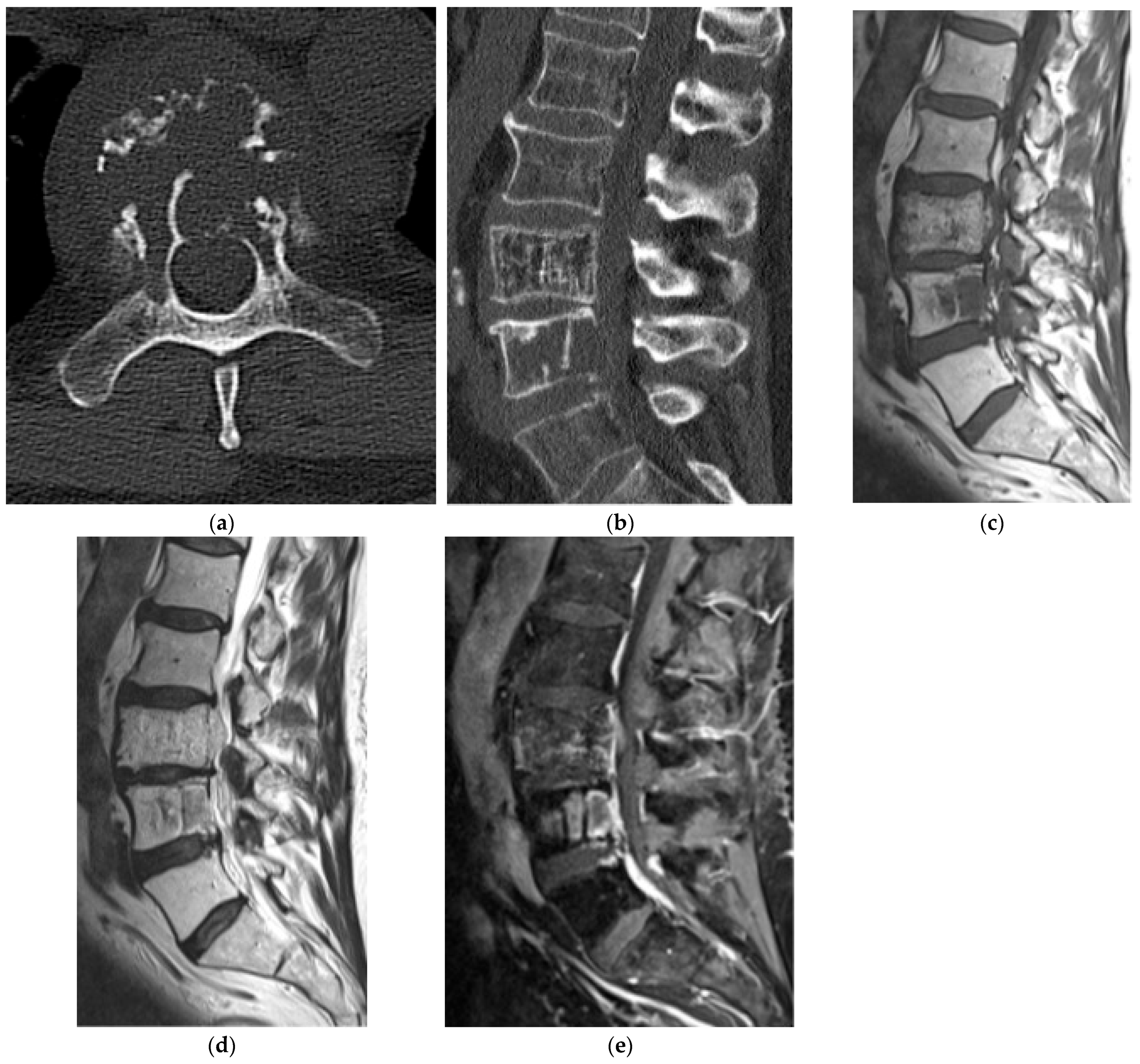Diagnostics 15 02970 g012 Diagnostics 15 02970 g012
