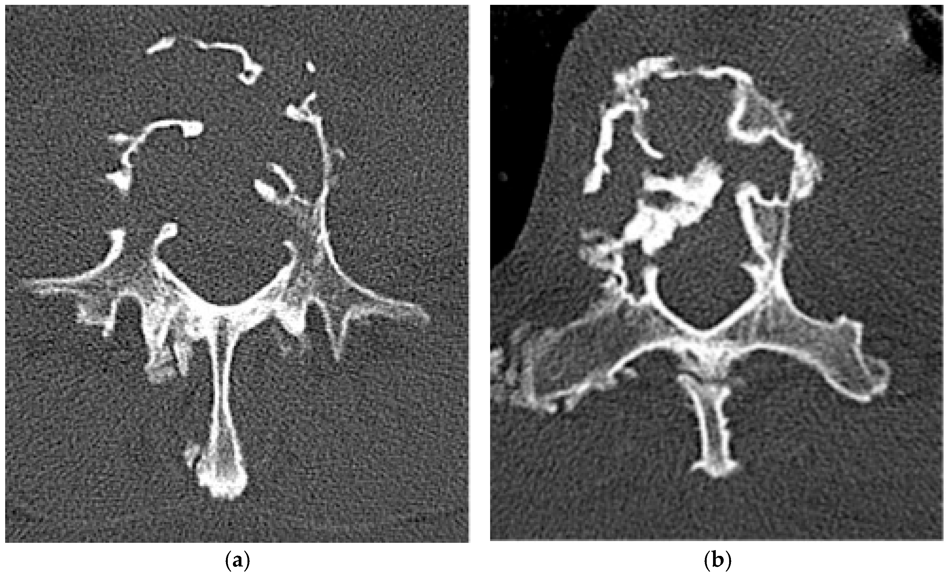 Diagnostics 15 02970 g013 Diagnostics 15 02970 g013