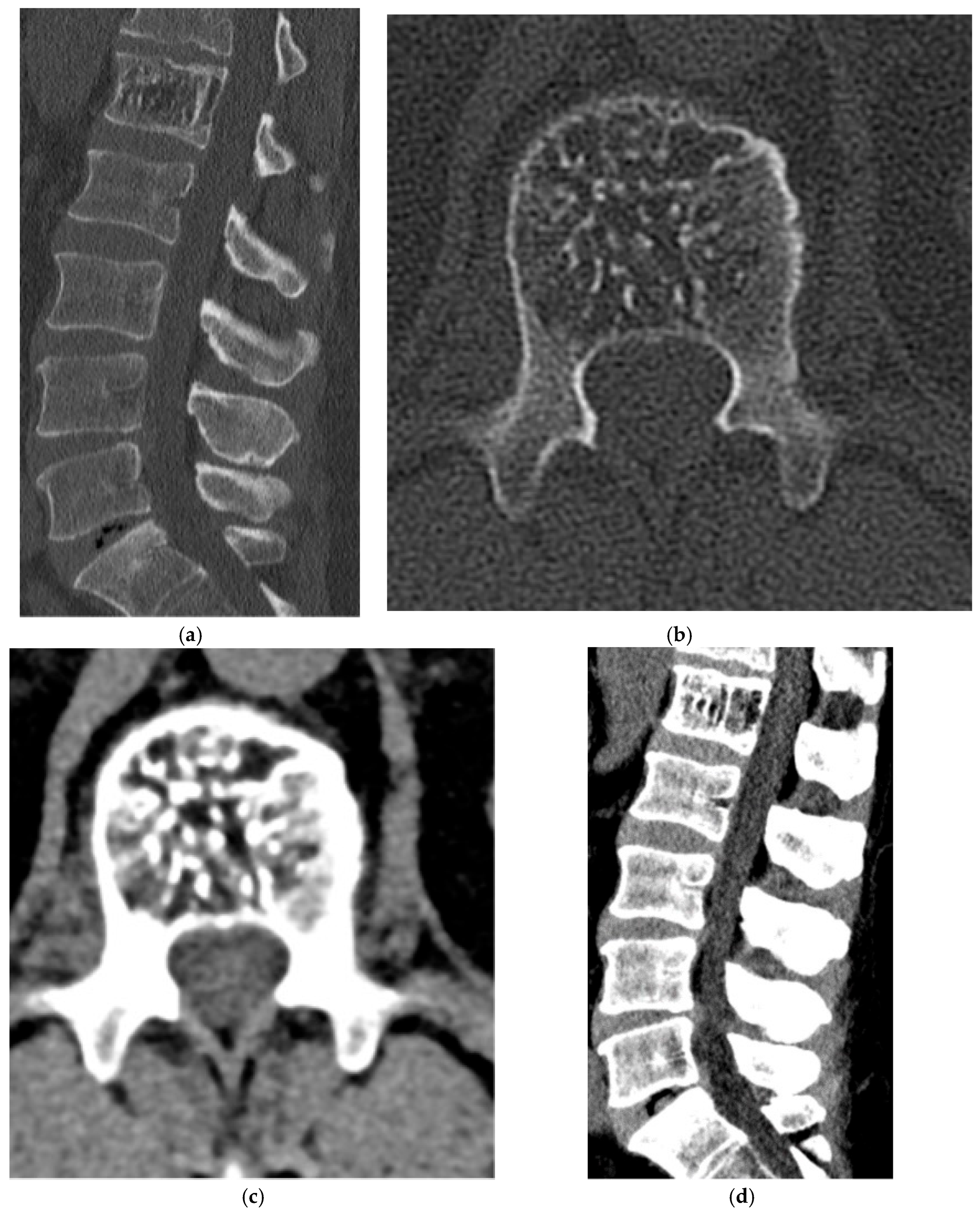 Diagnostics 15 02970 g015 Diagnostics 15 02970 g015