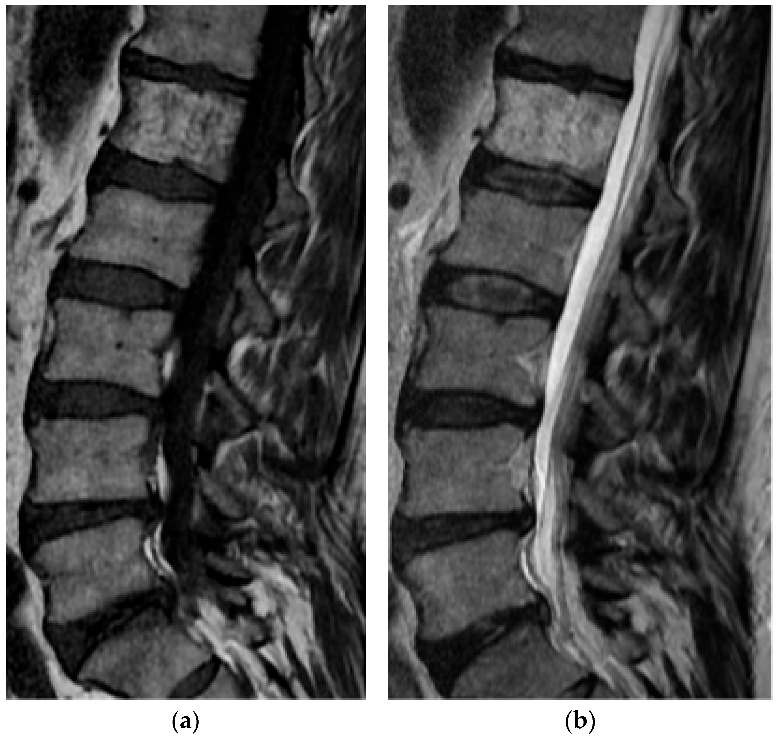 Diagnostics 15 02970 g016 Diagnostics 15 02970 g016