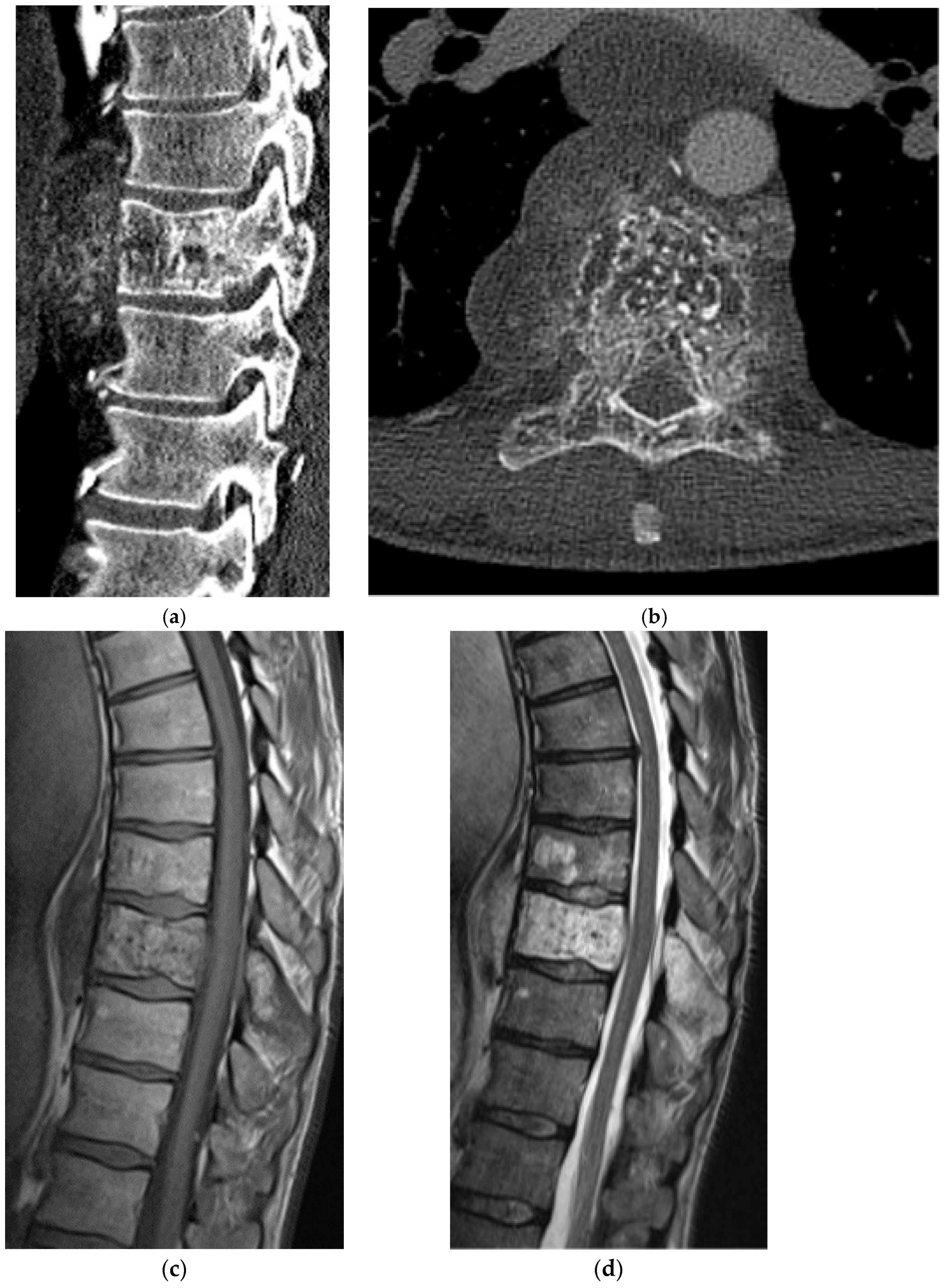 Diagnostics 15 02970 g017a Diagnostics 15 02970 g017a