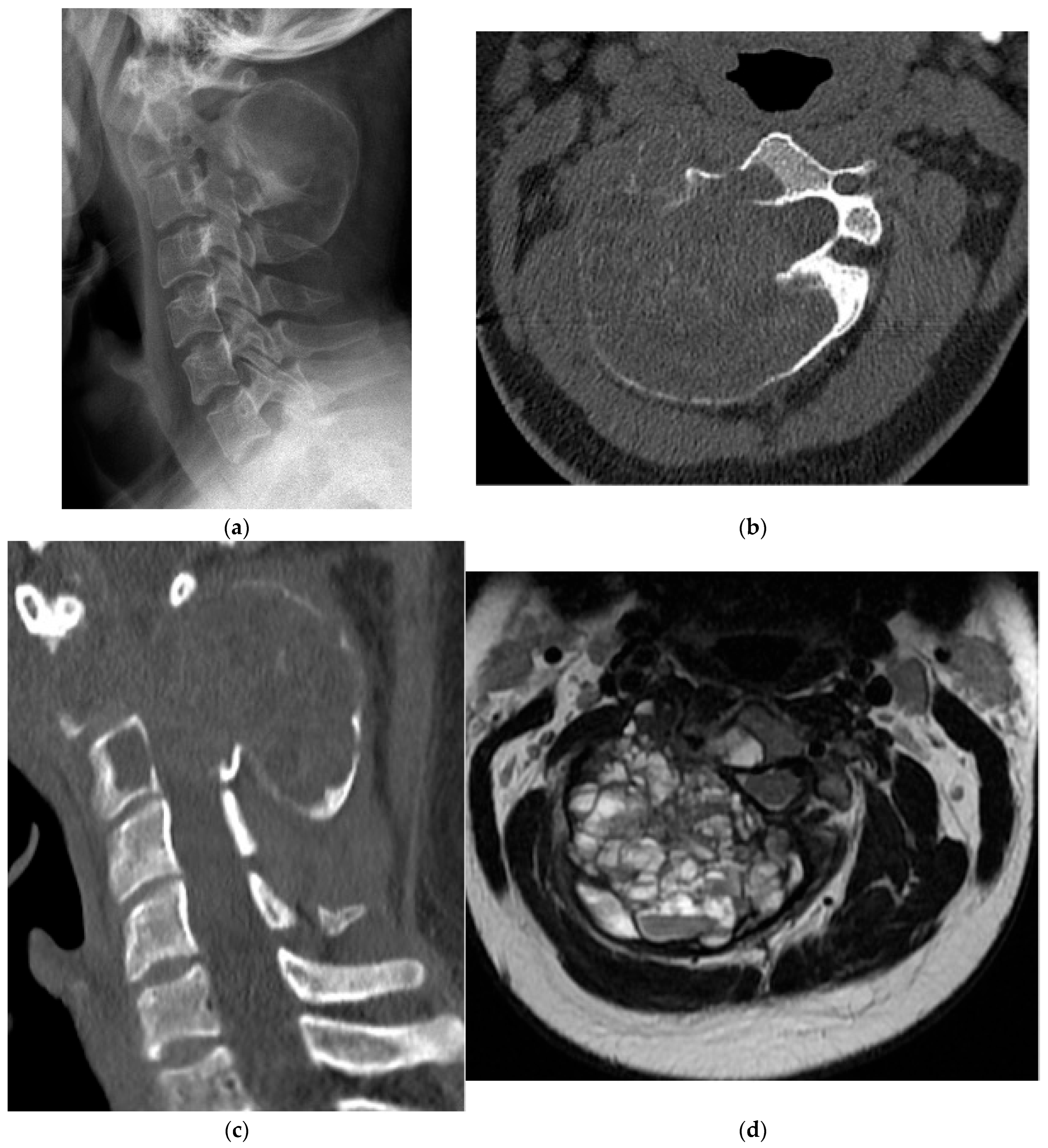 Diagnostics 15 02970 g018 Diagnostics 15 02970 g018