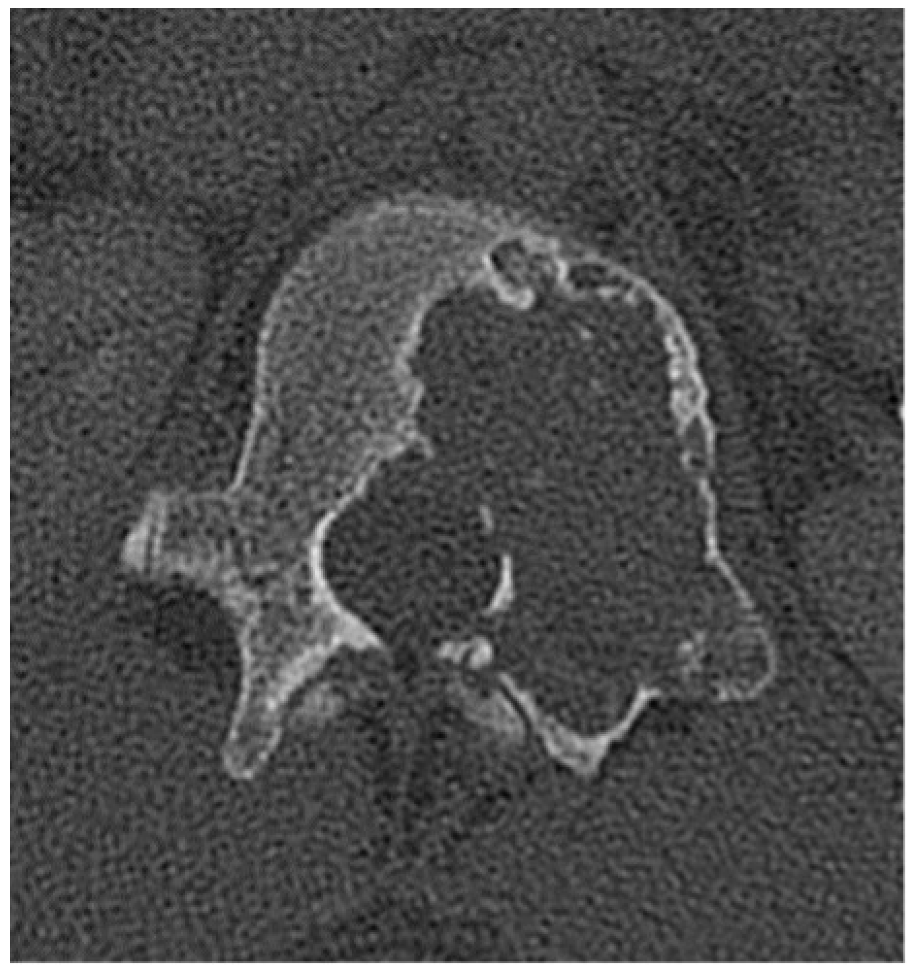 Diagnostics 15 02970 g021 Diagnostics 15 02970 g021