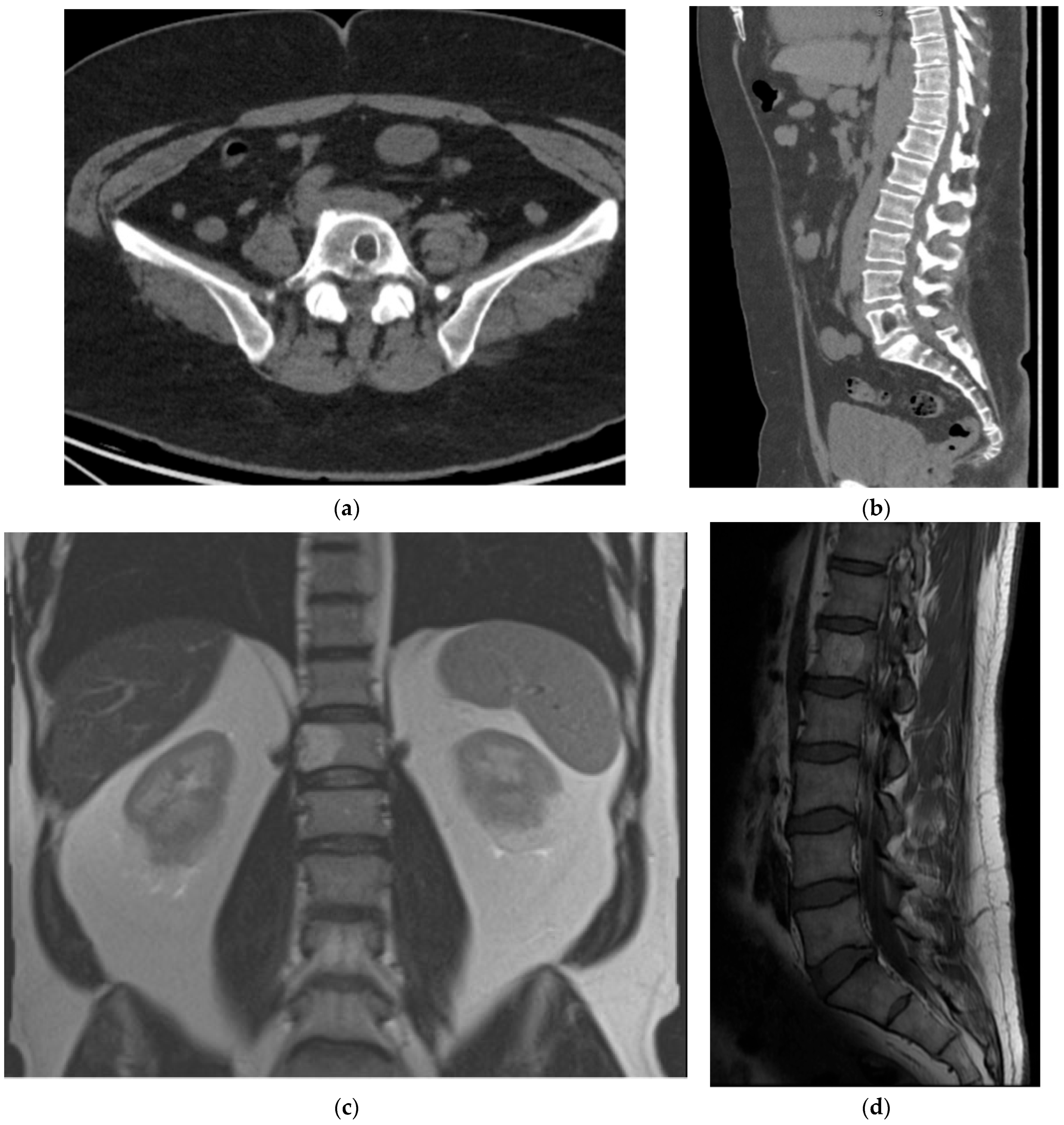 Diagnostics 15 02970 g022 Diagnostics 15 02970 g022