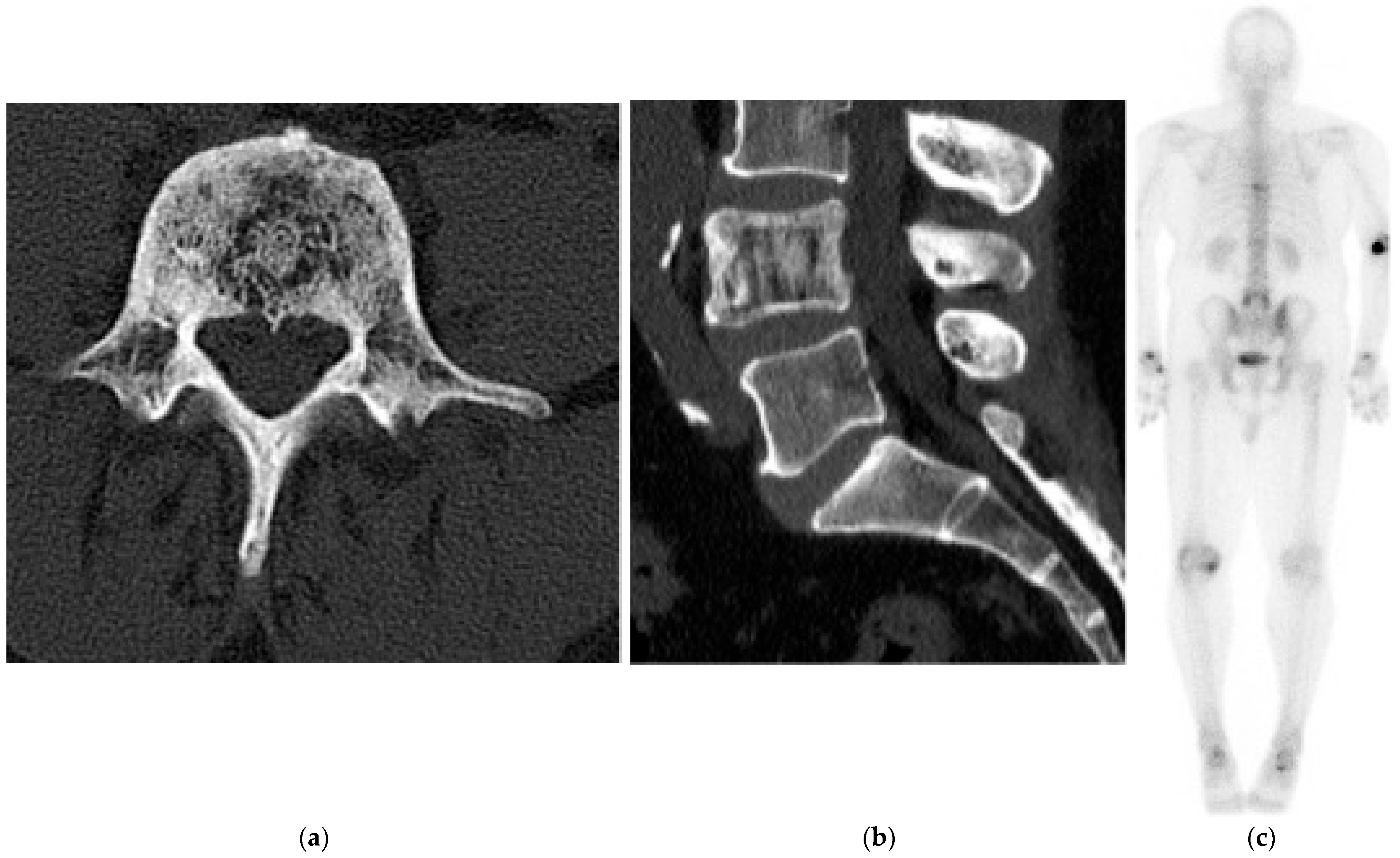 Diagnostics 15 02970 g023 Diagnostics 15 02970 g023