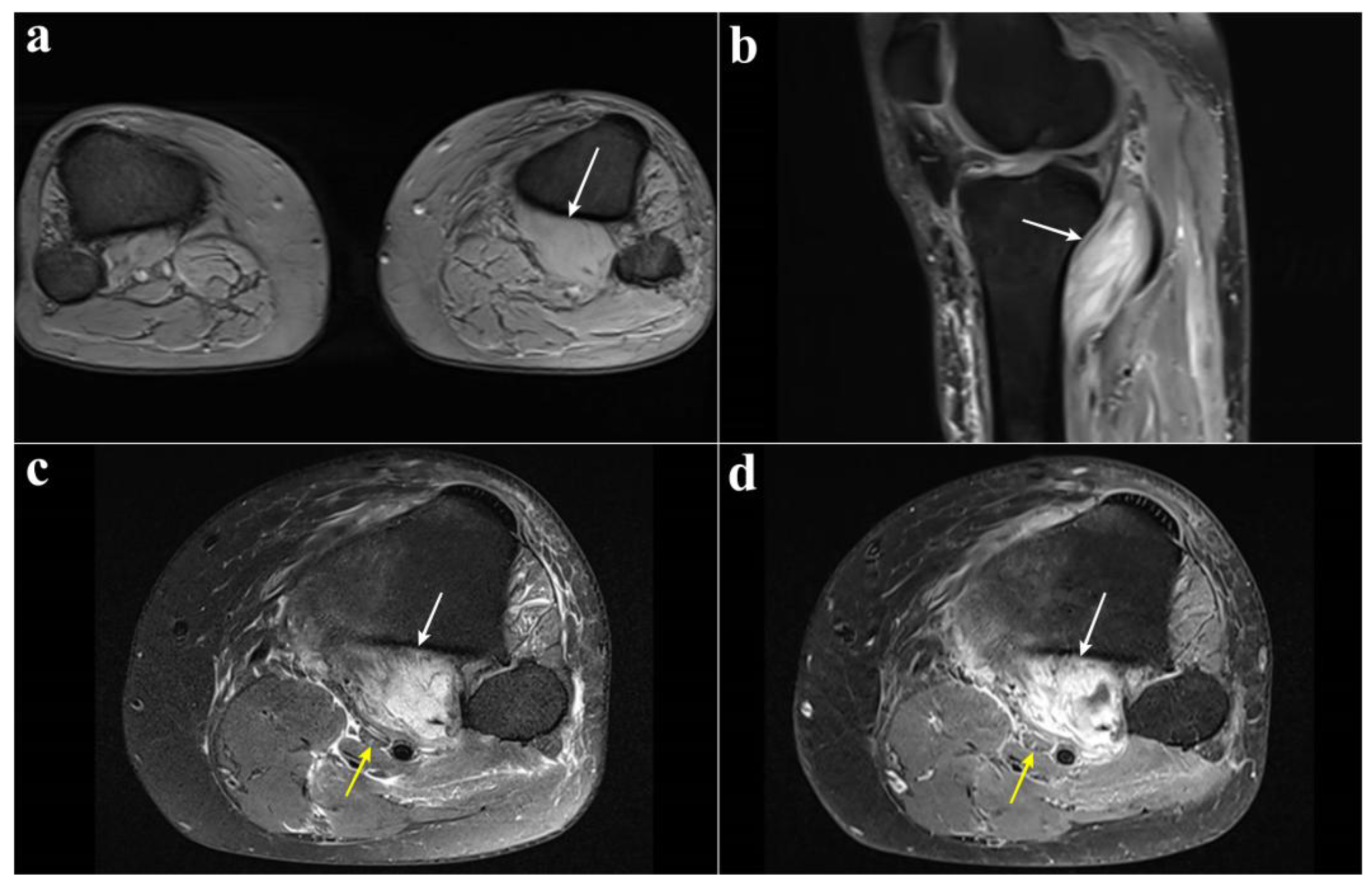 Diagnostics 15 02990 g003