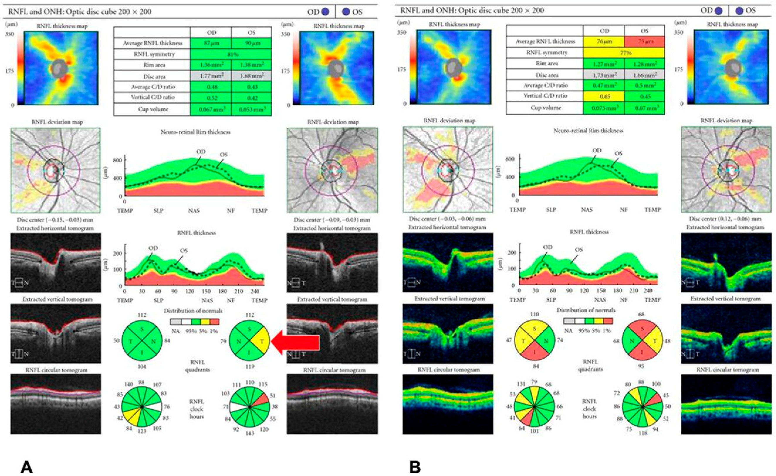 Diagnostics 15 03001 g002