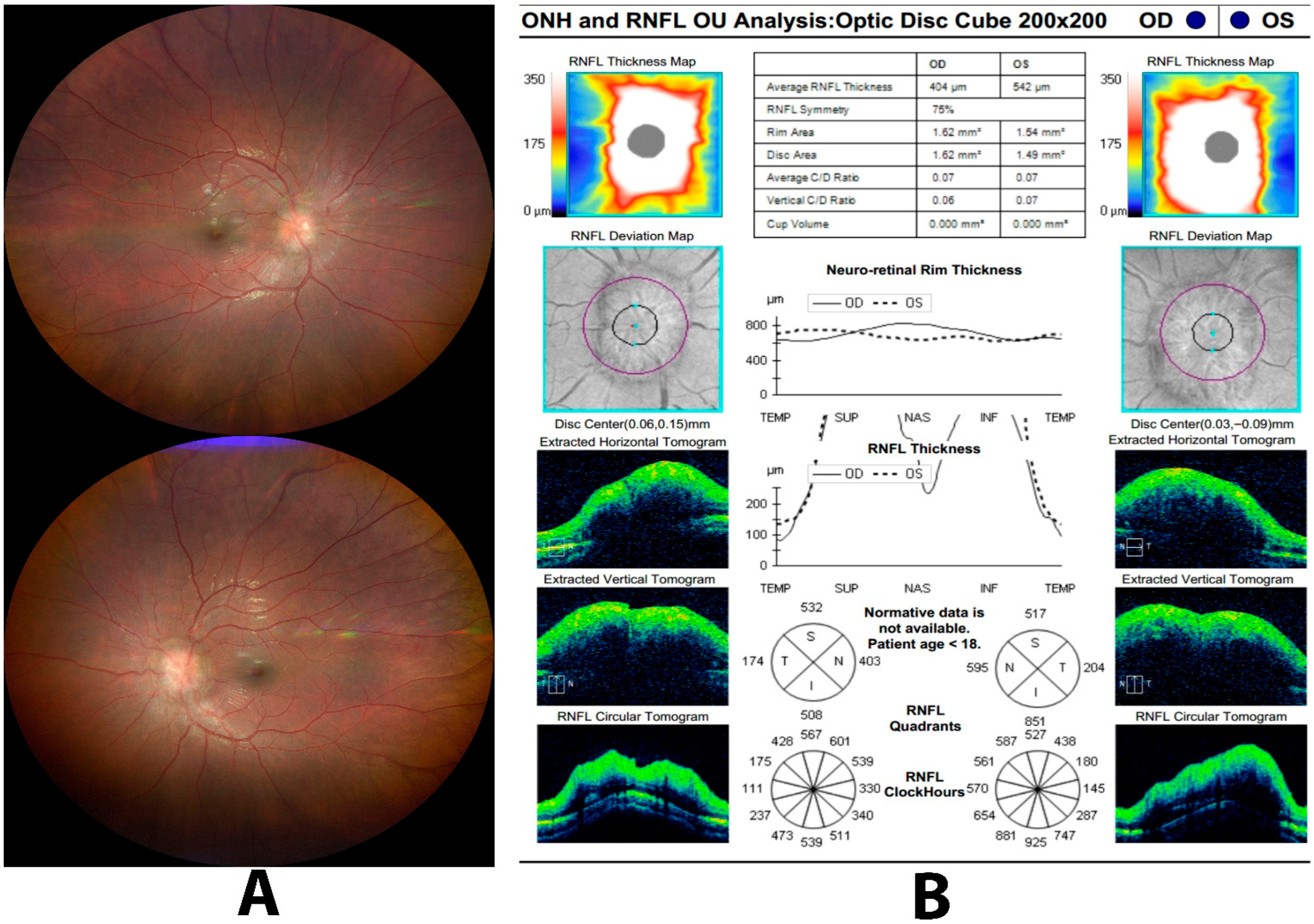 Diagnostics 15 03001 g003