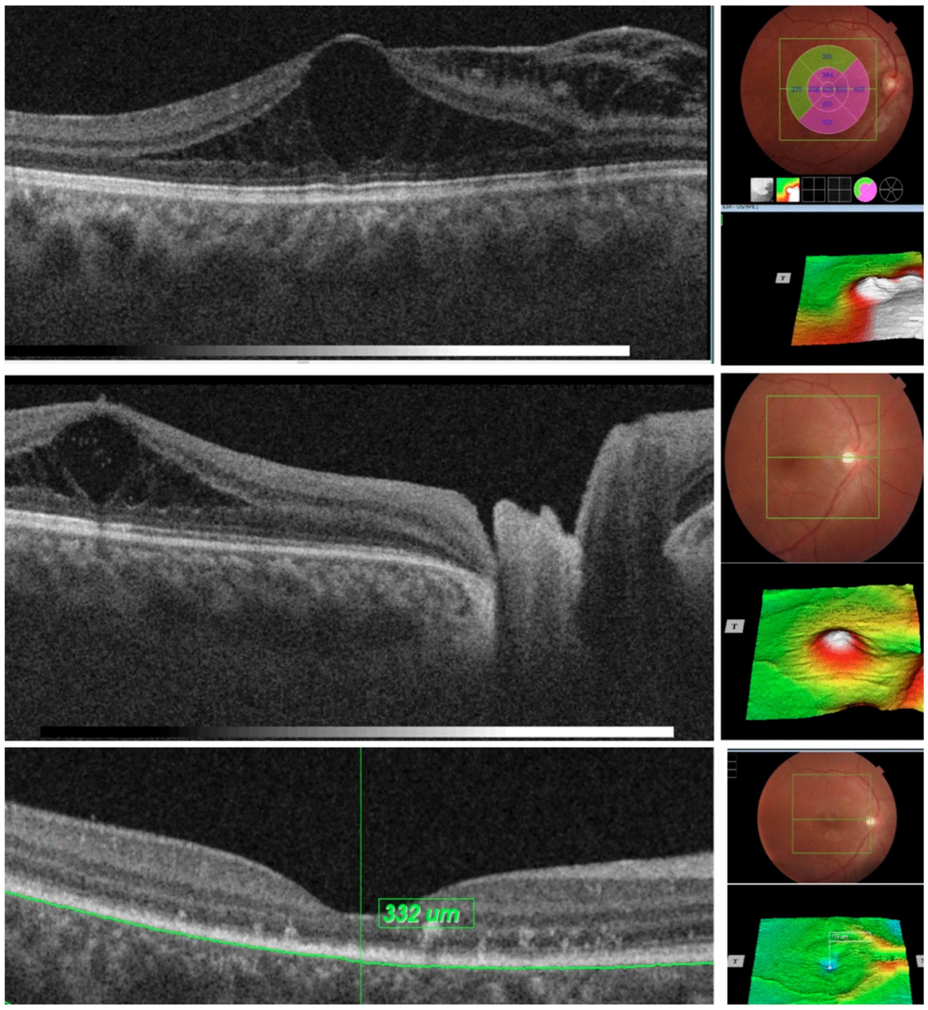 Diagnostics 15 03001 g004