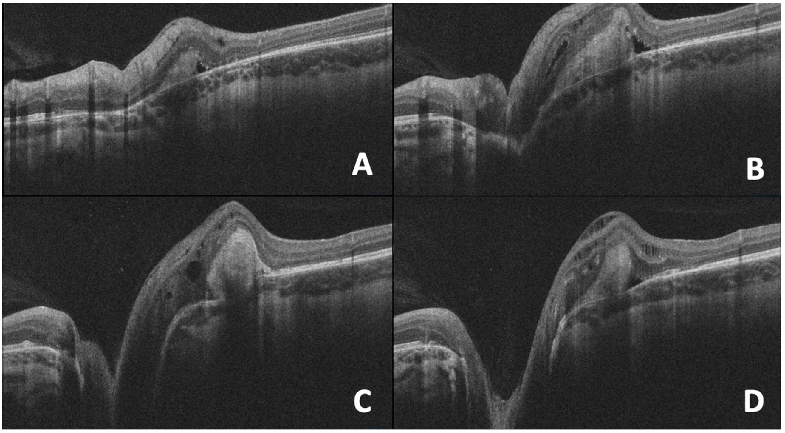Diagnostics 15 03001 g006