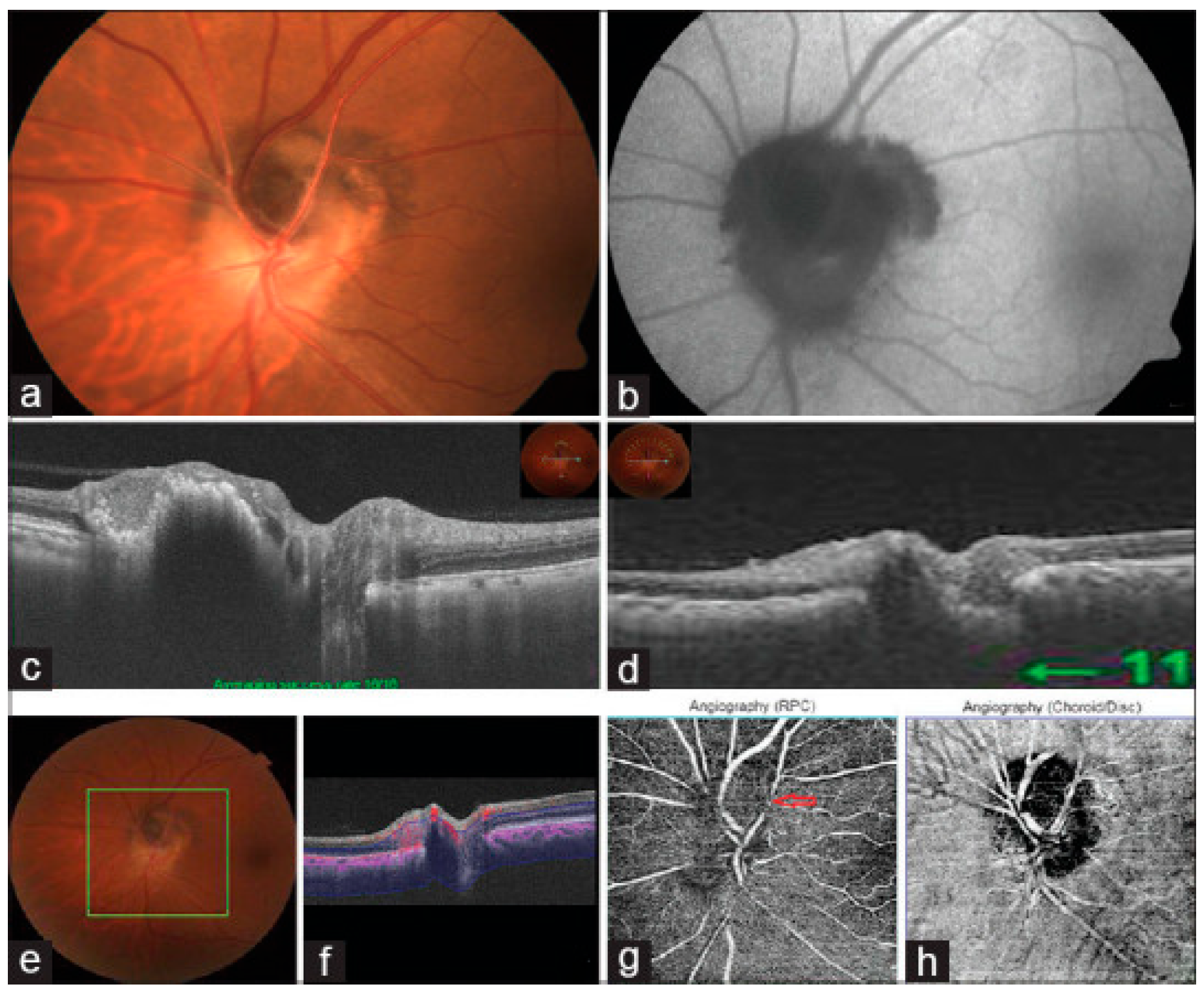 Diagnostics 15 03001 g007