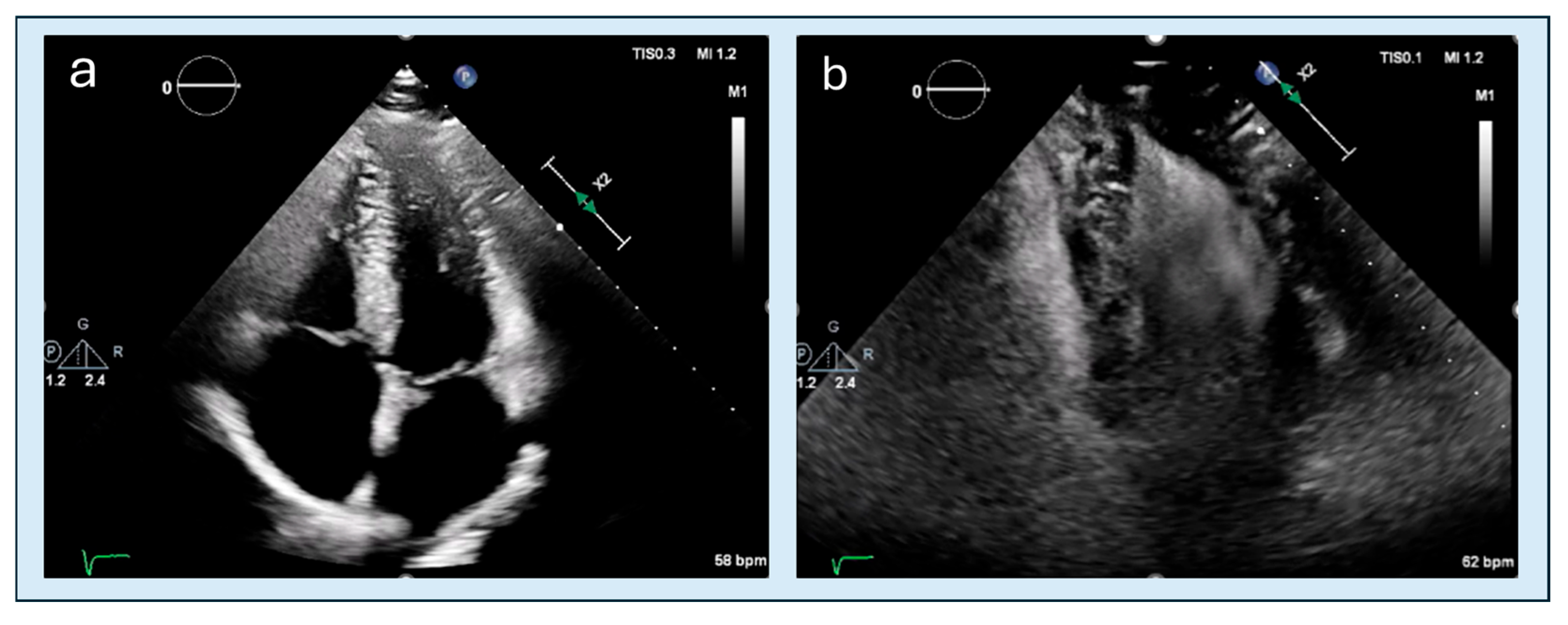 Diagnostics 15 03013 g002