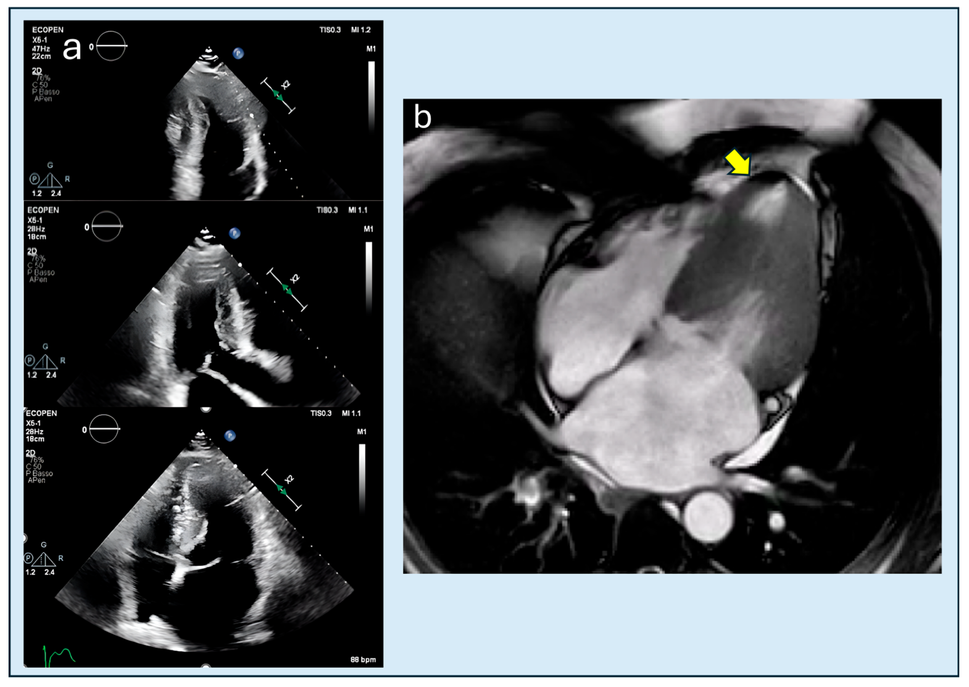Diagnostics 15 03013 g007