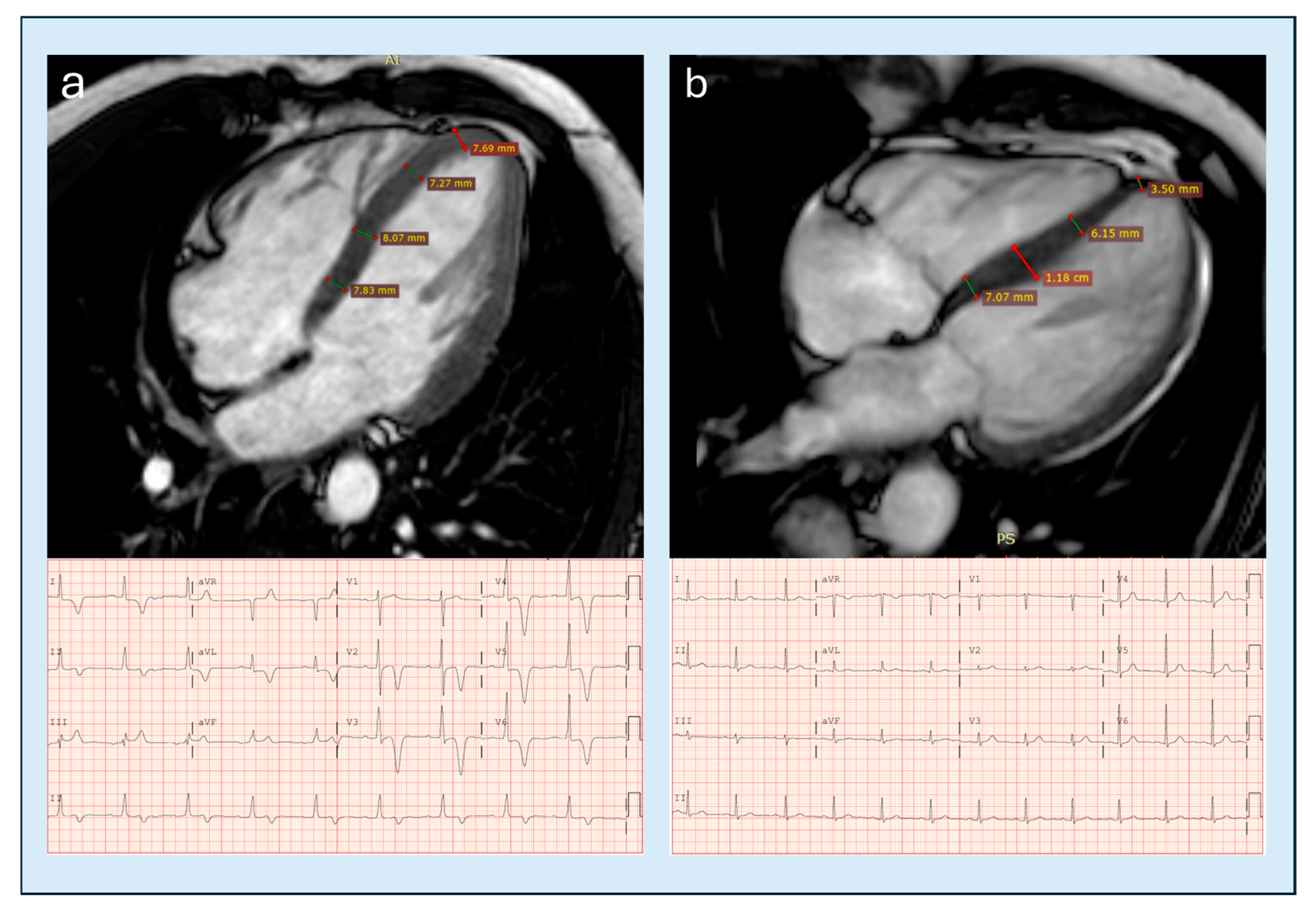 Diagnostics 15 03013 g010