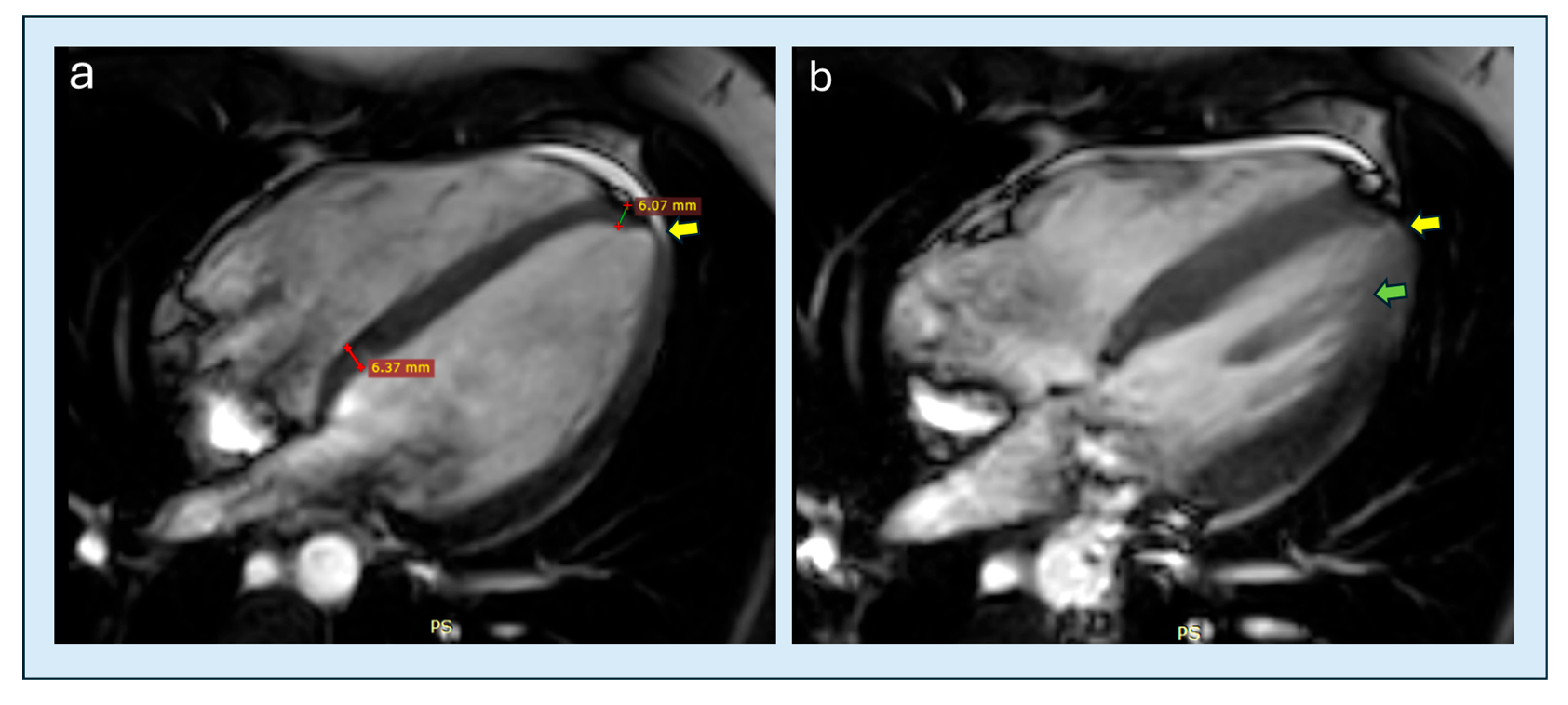 Diagnostics 15 03013 g011