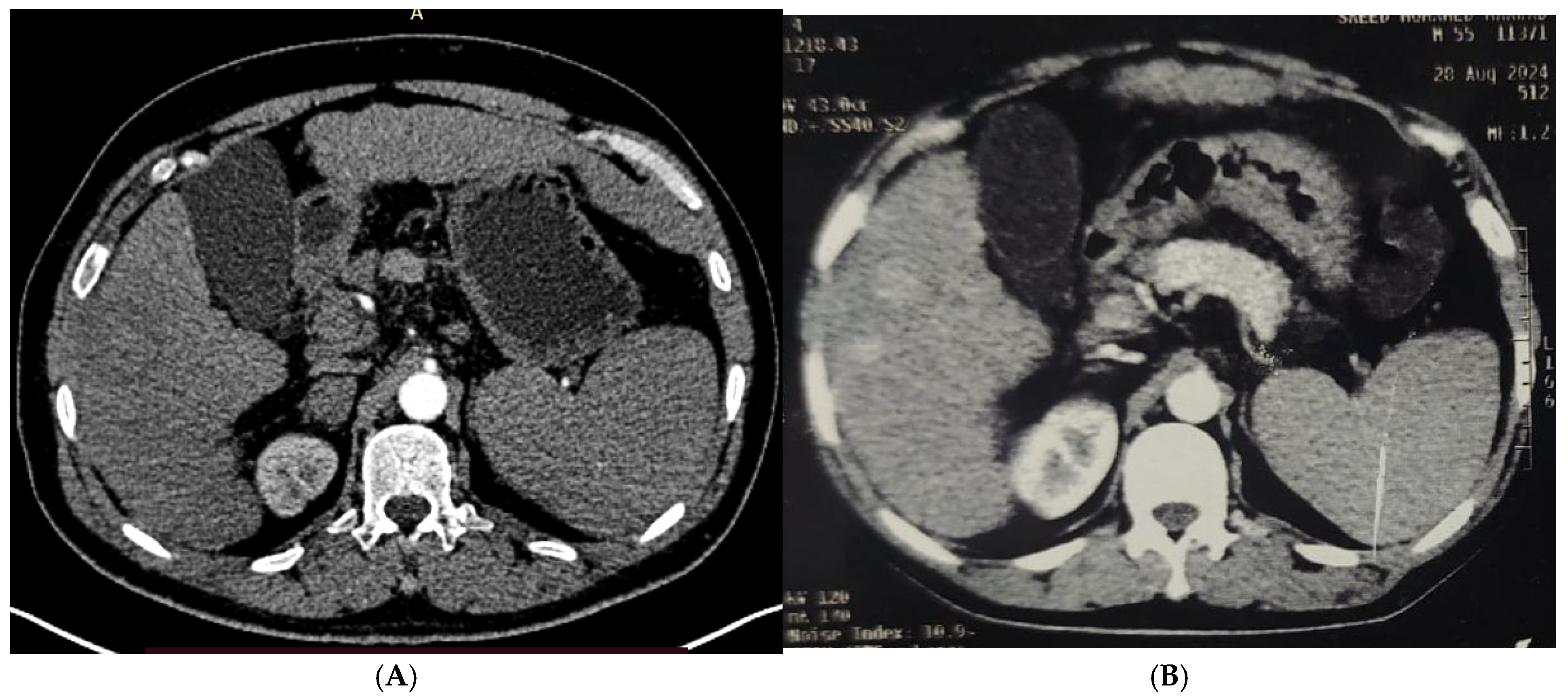 Diagnostics 15 03027 g002