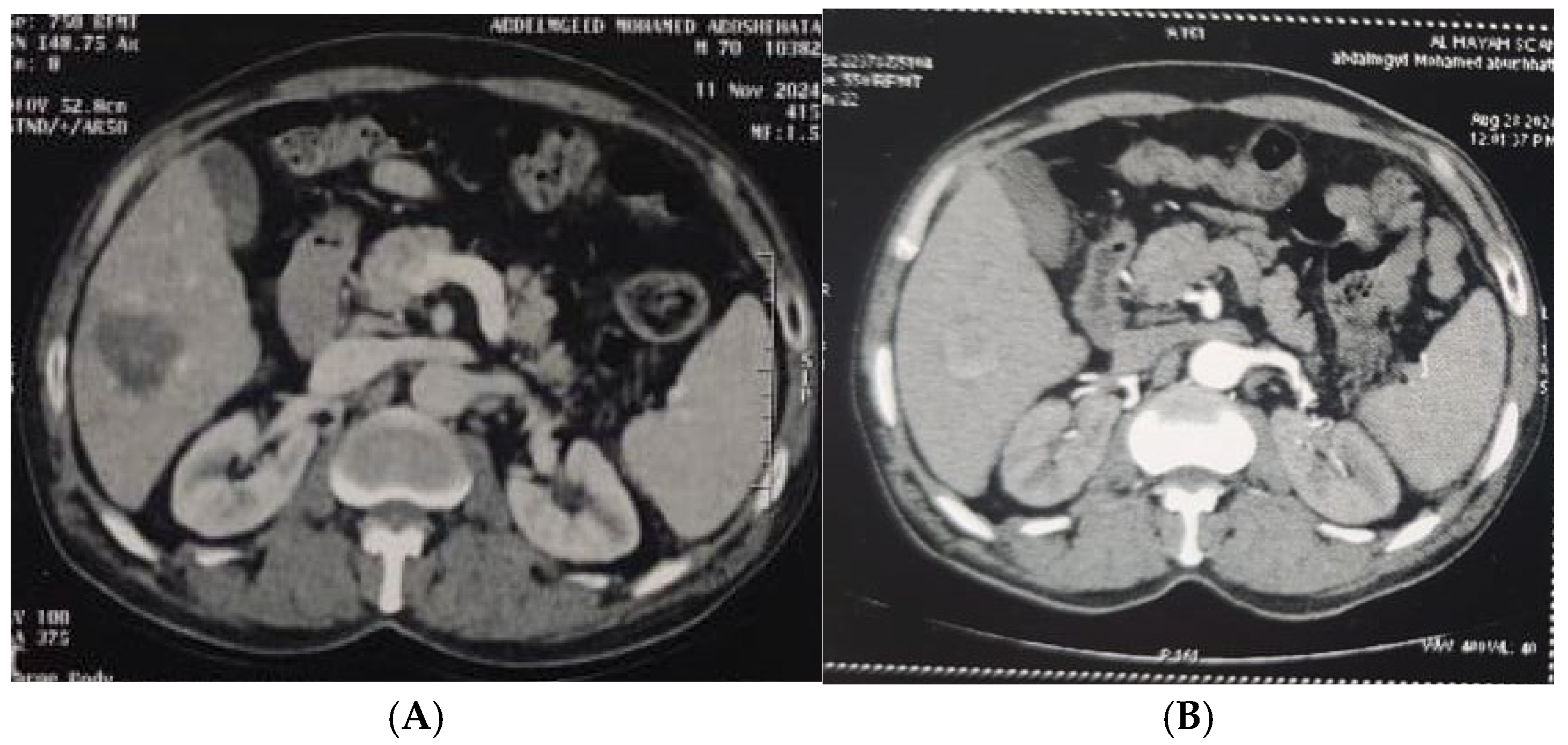 Diagnostics 15 03027 g003