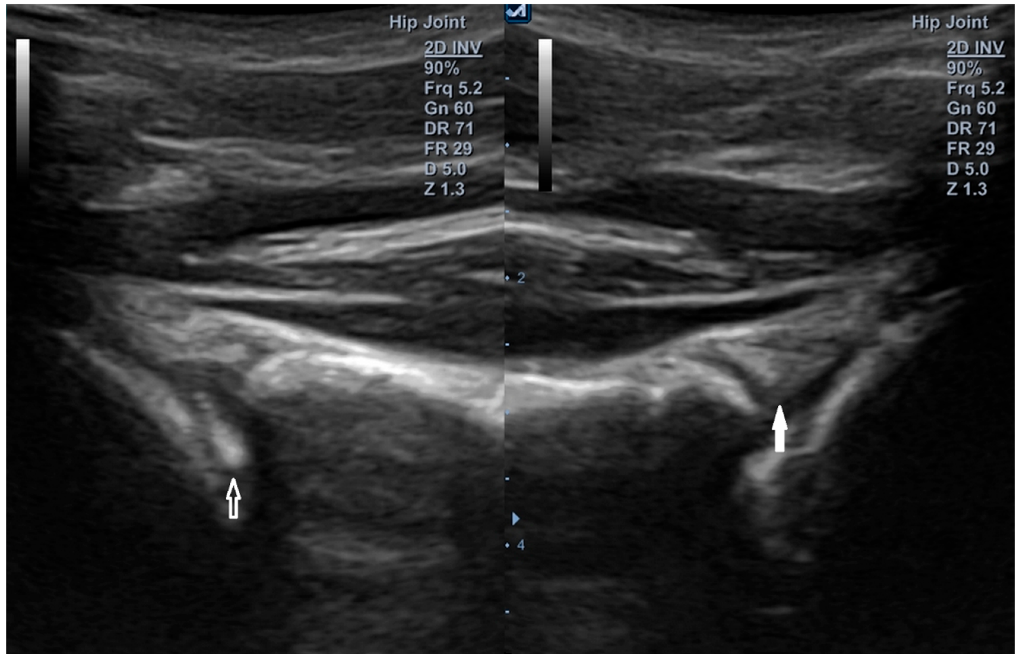 Diagnostics 15 03031 g014