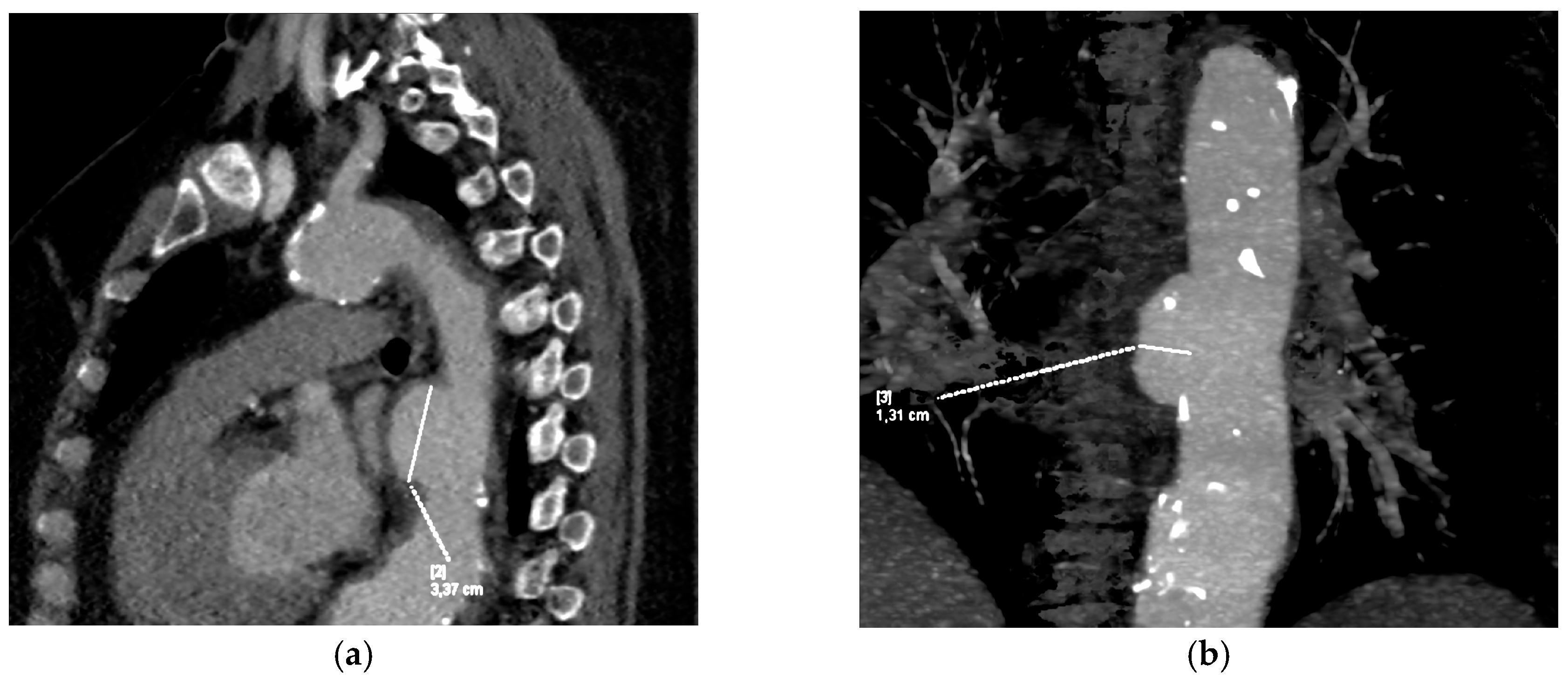 Diagnostics 15 03077 g001 Diagnostics 15 03077 g001