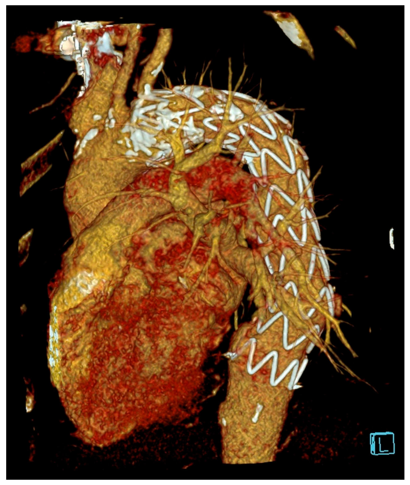 Diagnostics 15 03077 g002 Diagnostics 15 03077 g002