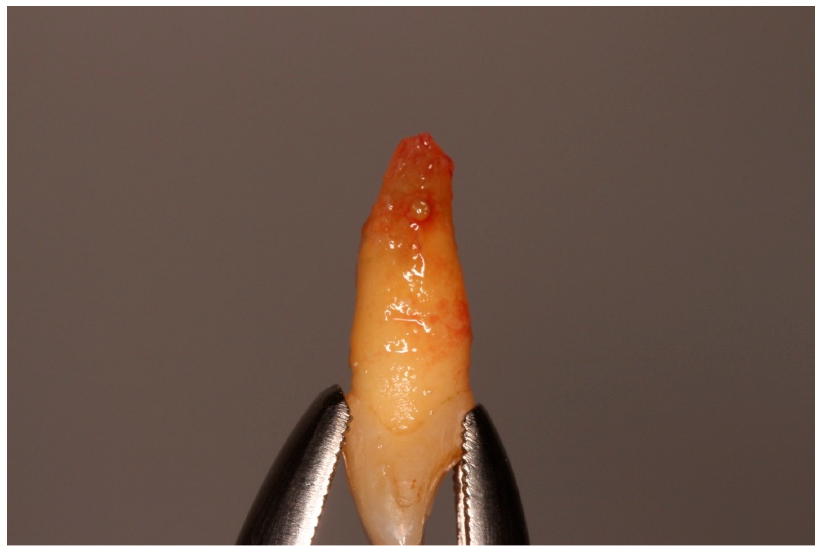 Diagnostics 15 03080 g004 Diagnostics 15 03080 g004