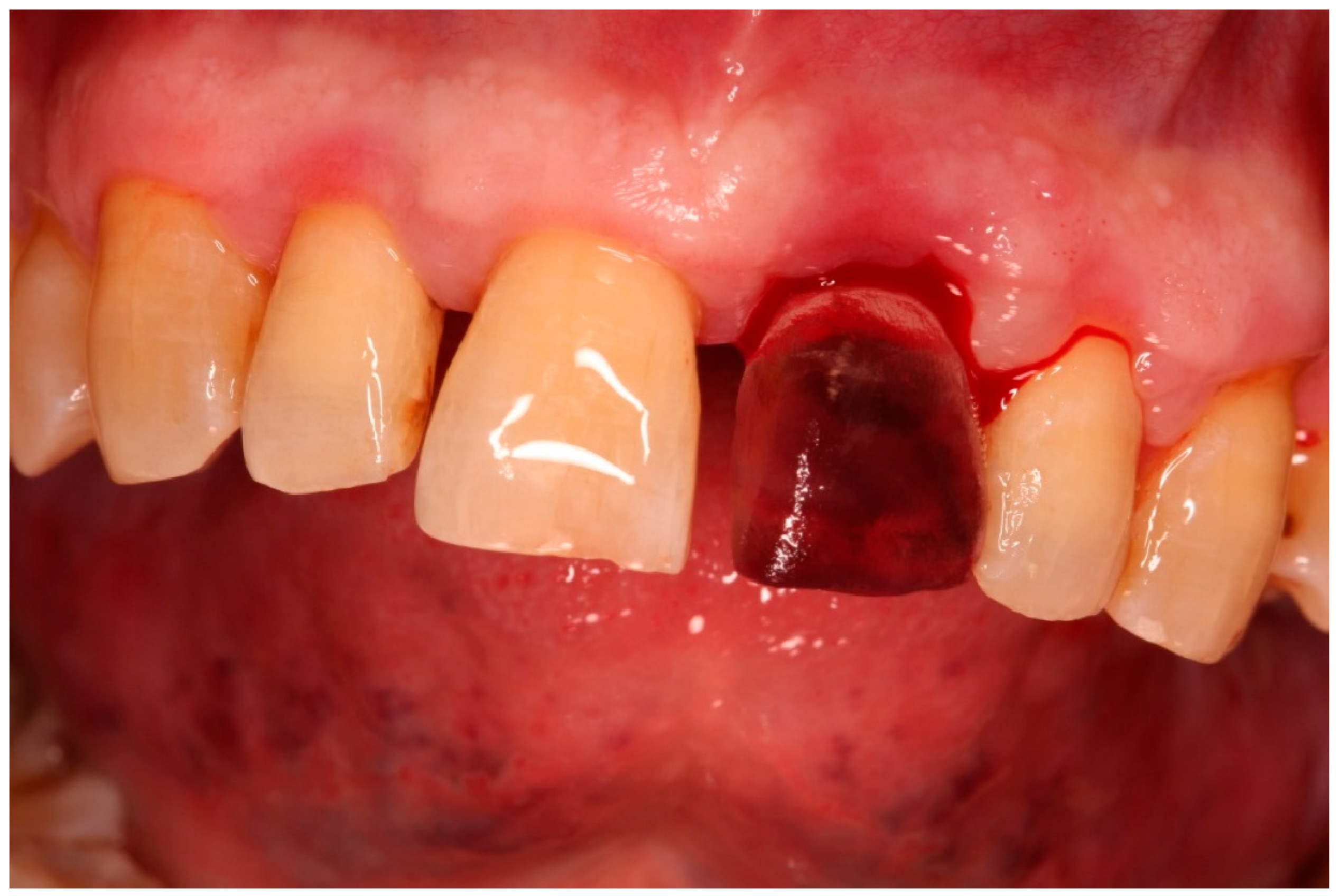 Diagnostics 15 03080 g006 Diagnostics 15 03080 g006