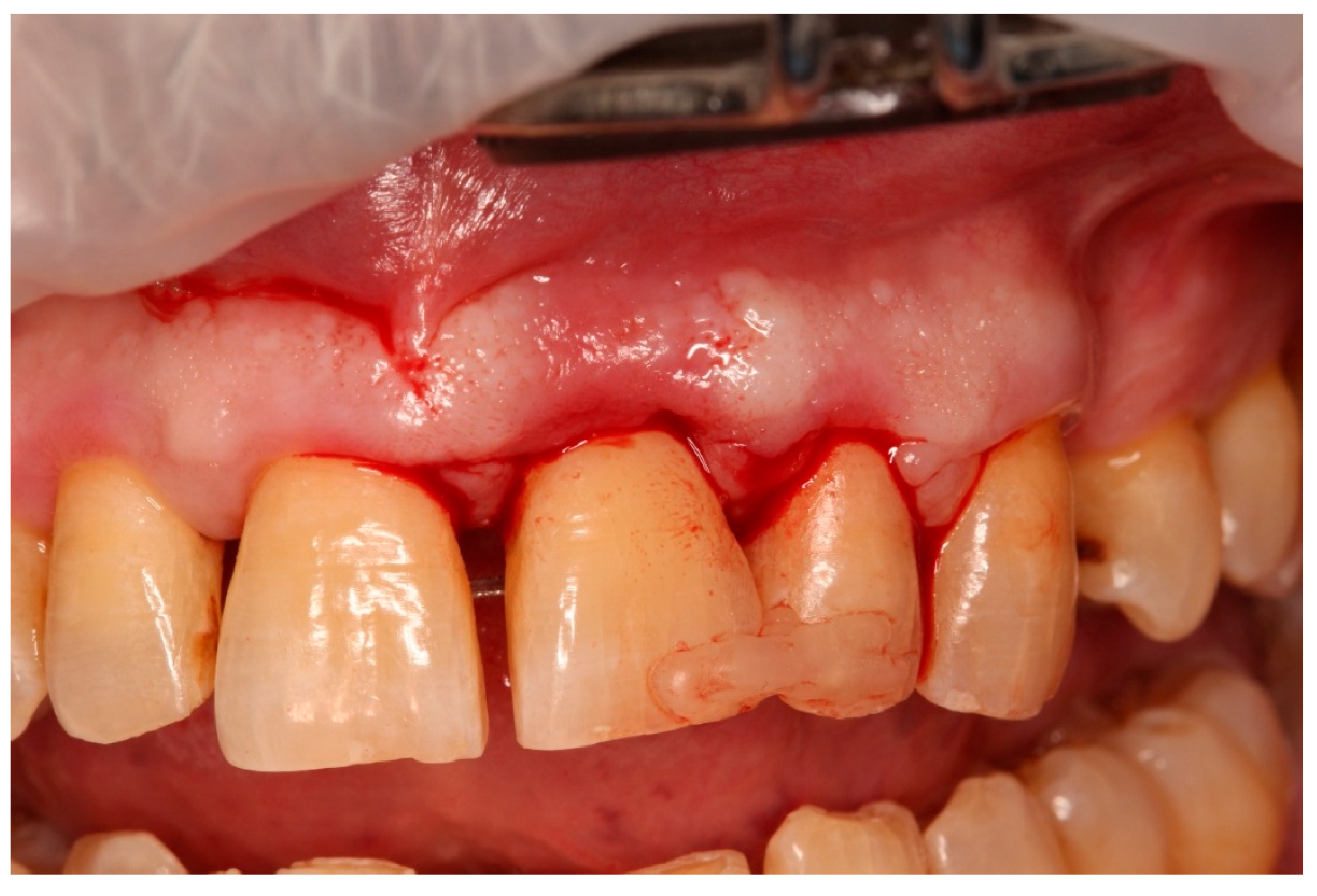 Diagnostics 15 03080 g008 Diagnostics 15 03080 g008