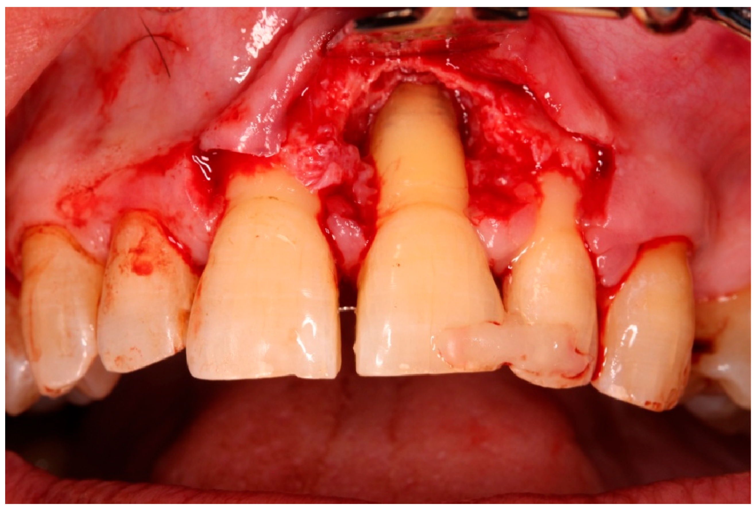 Diagnostics 15 03080 g009 Diagnostics 15 03080 g009