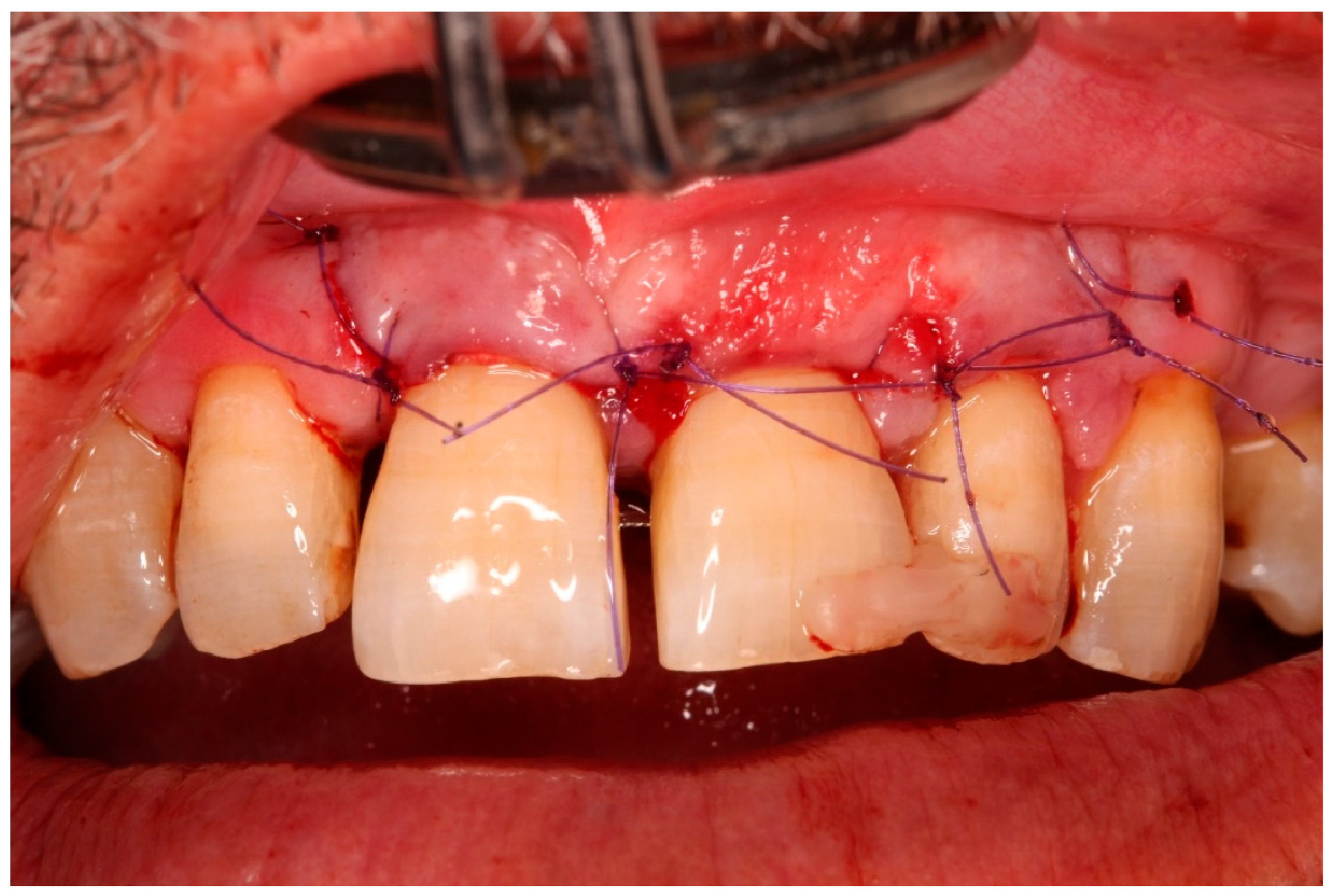 Diagnostics 15 03080 g010 Diagnostics 15 03080 g010