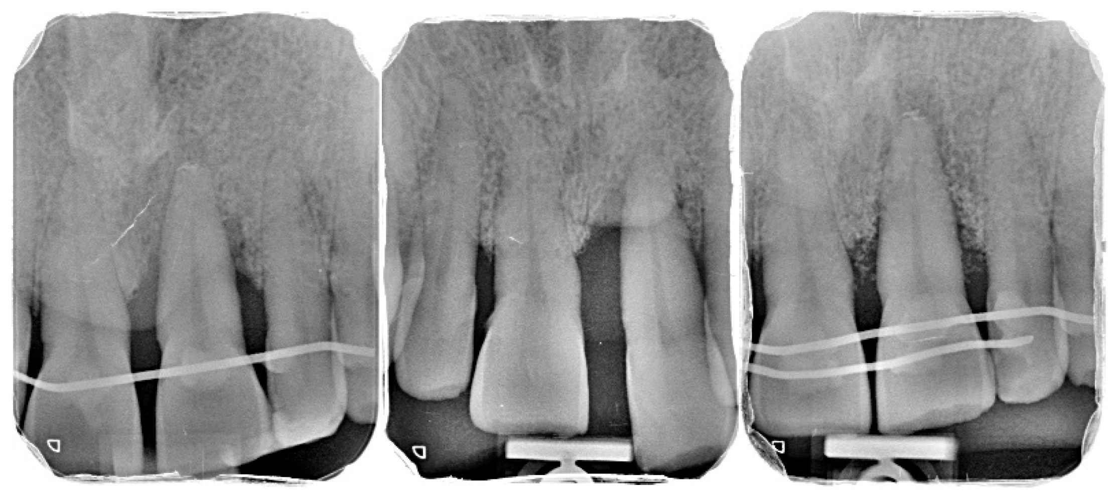 Diagnostics 15 03080 g011 Diagnostics 15 03080 g011