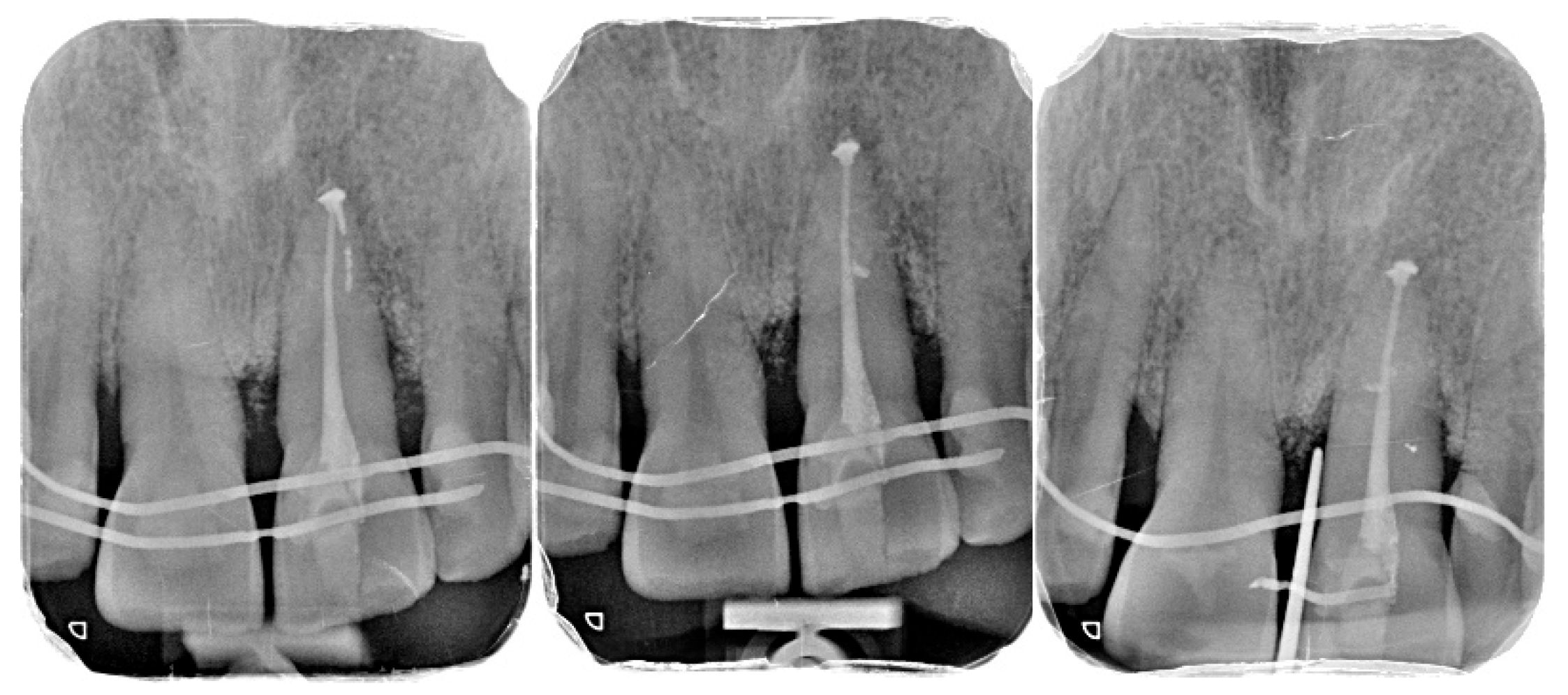 Diagnostics 15 03080 g012 Diagnostics 15 03080 g012