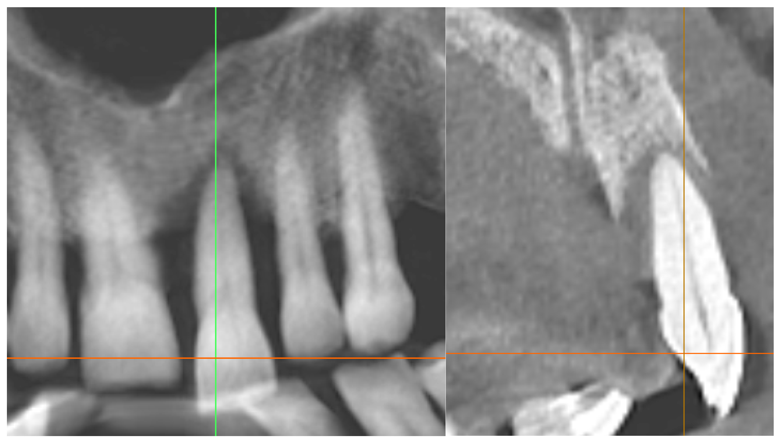 Diagnostics 15 03080 g013 Diagnostics 15 03080 g013