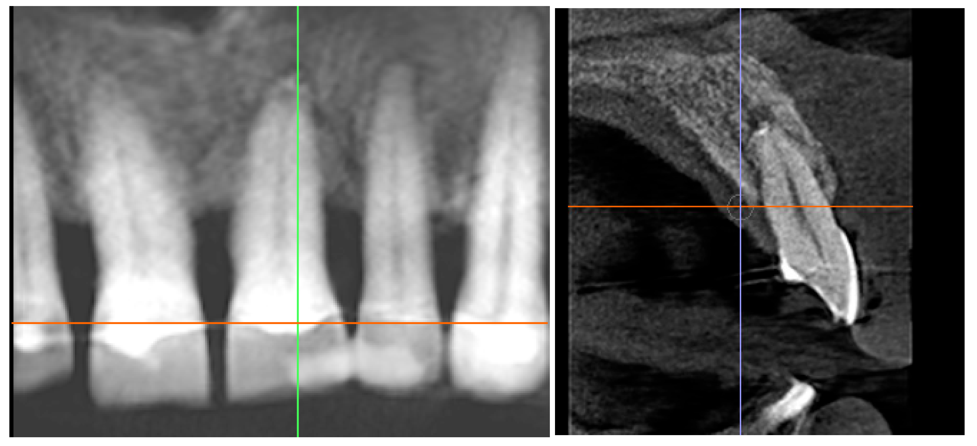 Diagnostics 15 03080 g014 Diagnostics 15 03080 g014