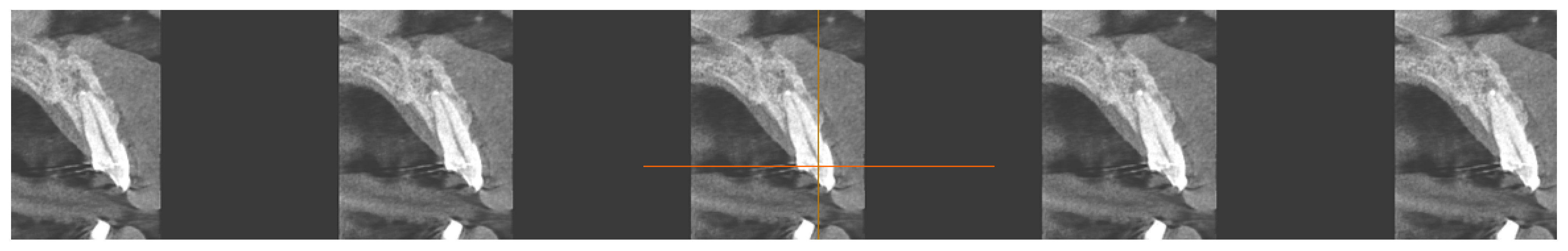 Diagnostics 15 03080 g015 Diagnostics 15 03080 g015
