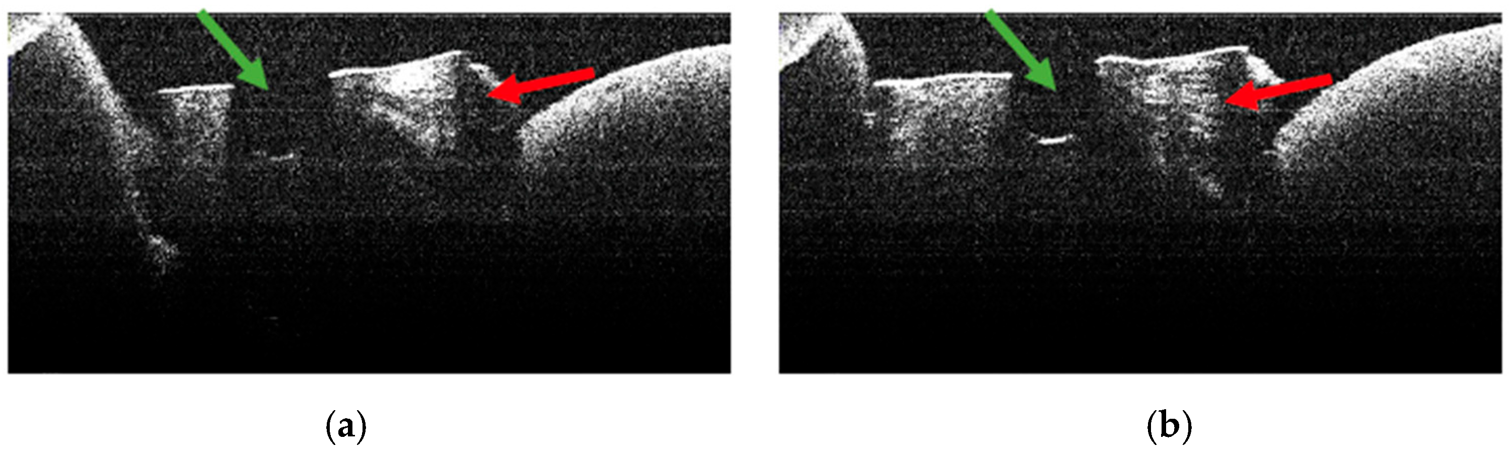 Diagnostics 15 03083 g014