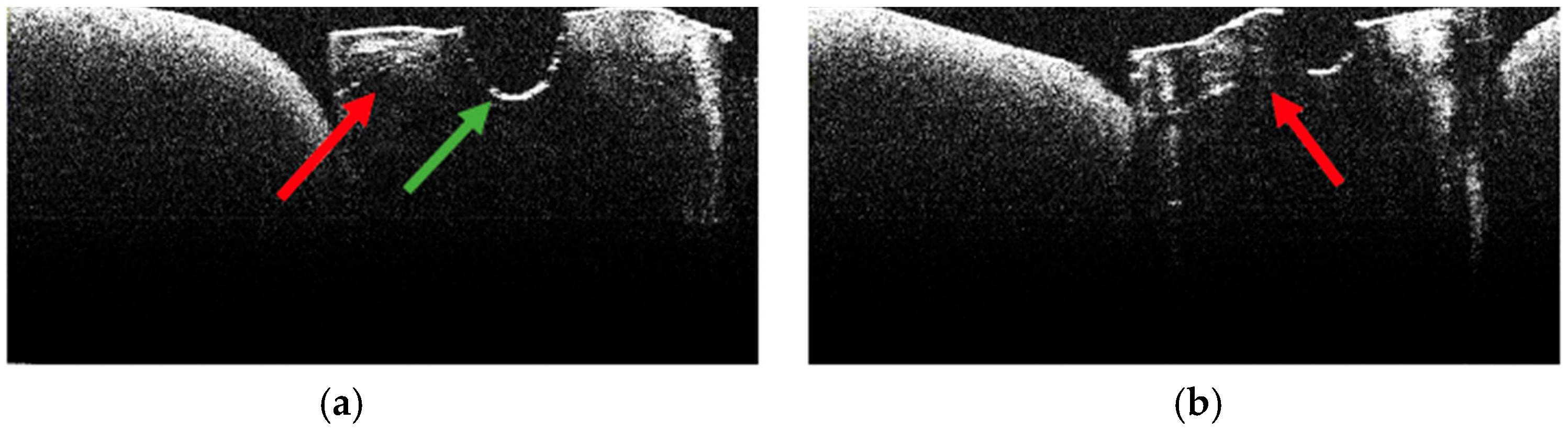 Diagnostics 15 03083 g015